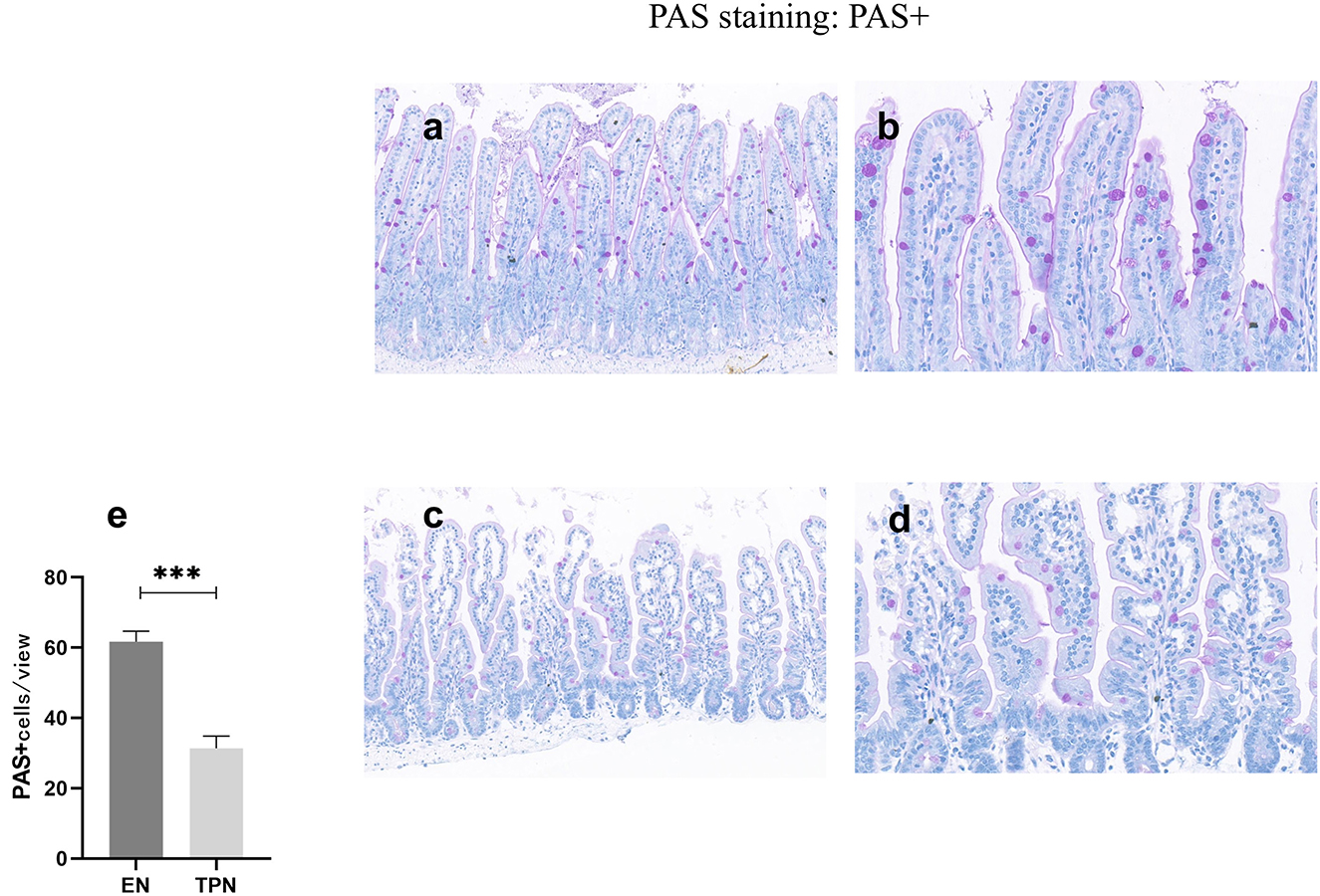 Four-panel image showing PAS+ staining in tissue slides from two groups, EN (a, b) and TPN (c, d). Panels a and c have a 100 mm scale, and panels b and d have a 50 mm scale. Staining highlights cell structures in shades of purple and blue. A bar graph labeled e displays significantly higher PAS+ cell counts in the EN group compared to the TPN group, with asterisks indicating statistical significance.