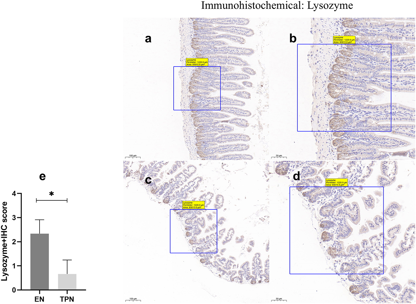 Immunohistochemical analysis of lysozyme in intestinal tissue sections, labeled as EN and TPN groups. Images a and b represent the EN group with scale bars of one hundred millimeters and fifty millimeters, respectively. Images c and d depict the TPN group with similar scale bars. A bar graph labeled e compares the lysozyme IHC score between EN and TPN groups, indicating a higher score for EN, with statistical significance noted by an asterisk.