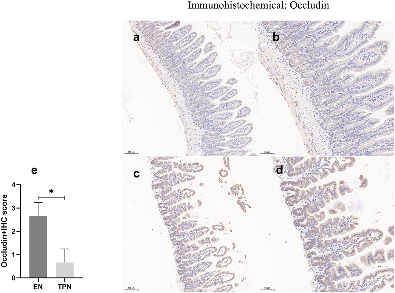 Immunohistochemical images of occludin expression in two groups: EN (a, b) with scale bars of 100 mm and 50 mm, and TPN (c, d) with the same scale bars. A bar graph (e) shows higher occludin-IHC scores in the EN group compared to TPN, with a significant difference marked by an asterisk.