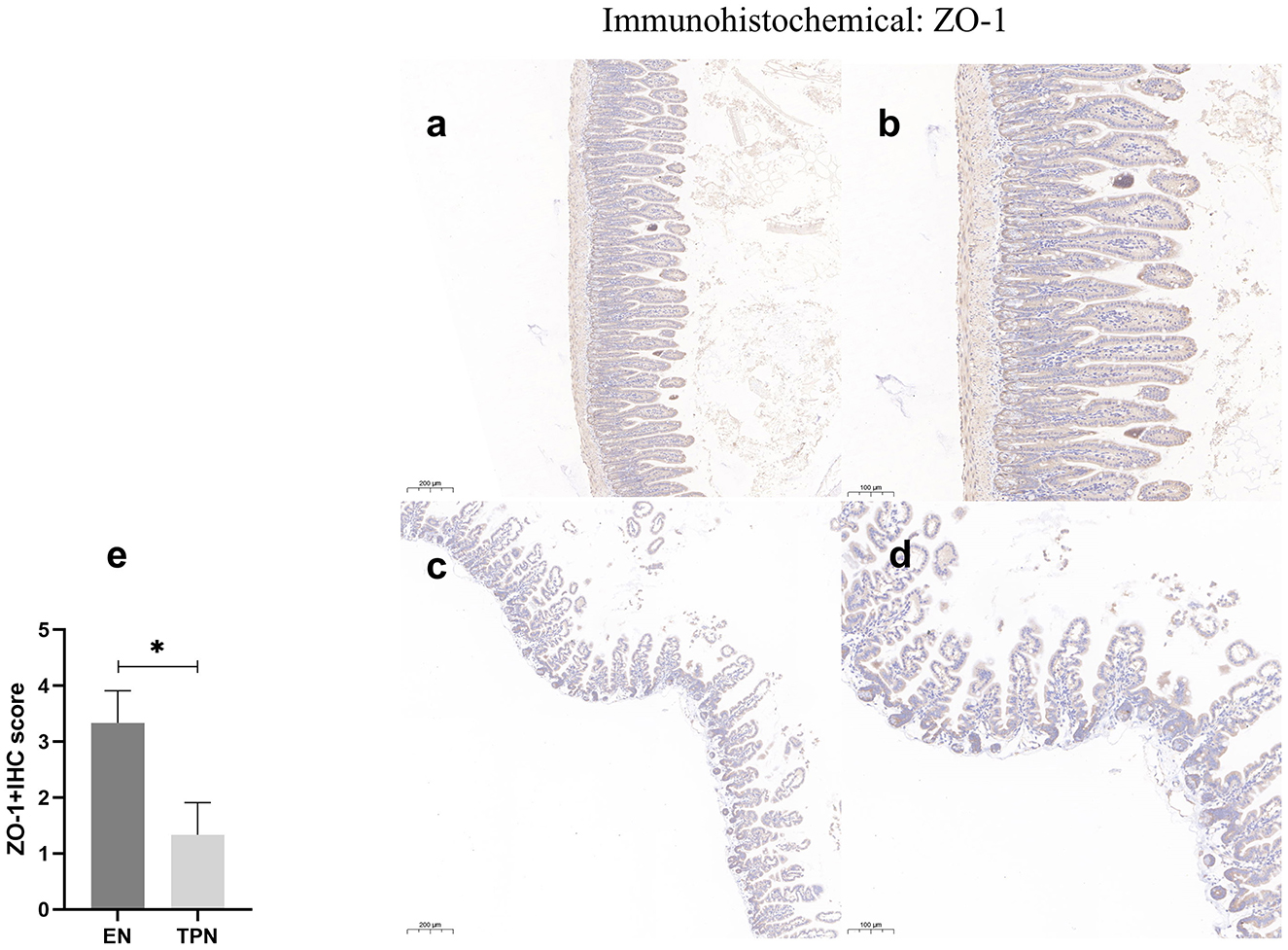 Immunohistochemical analysis of ZO-1 in EN and TPN groups with scale bars indicating 100 micrometers and 50 micrometers for images (a) to (d). Images (a) and (b) show EN group tissues, while (c) and (d) depict TPN group tissues. Chart (e) presents a bar graph comparing ZO-1 IHC scores between EN and TPN, with EN scoring higher.