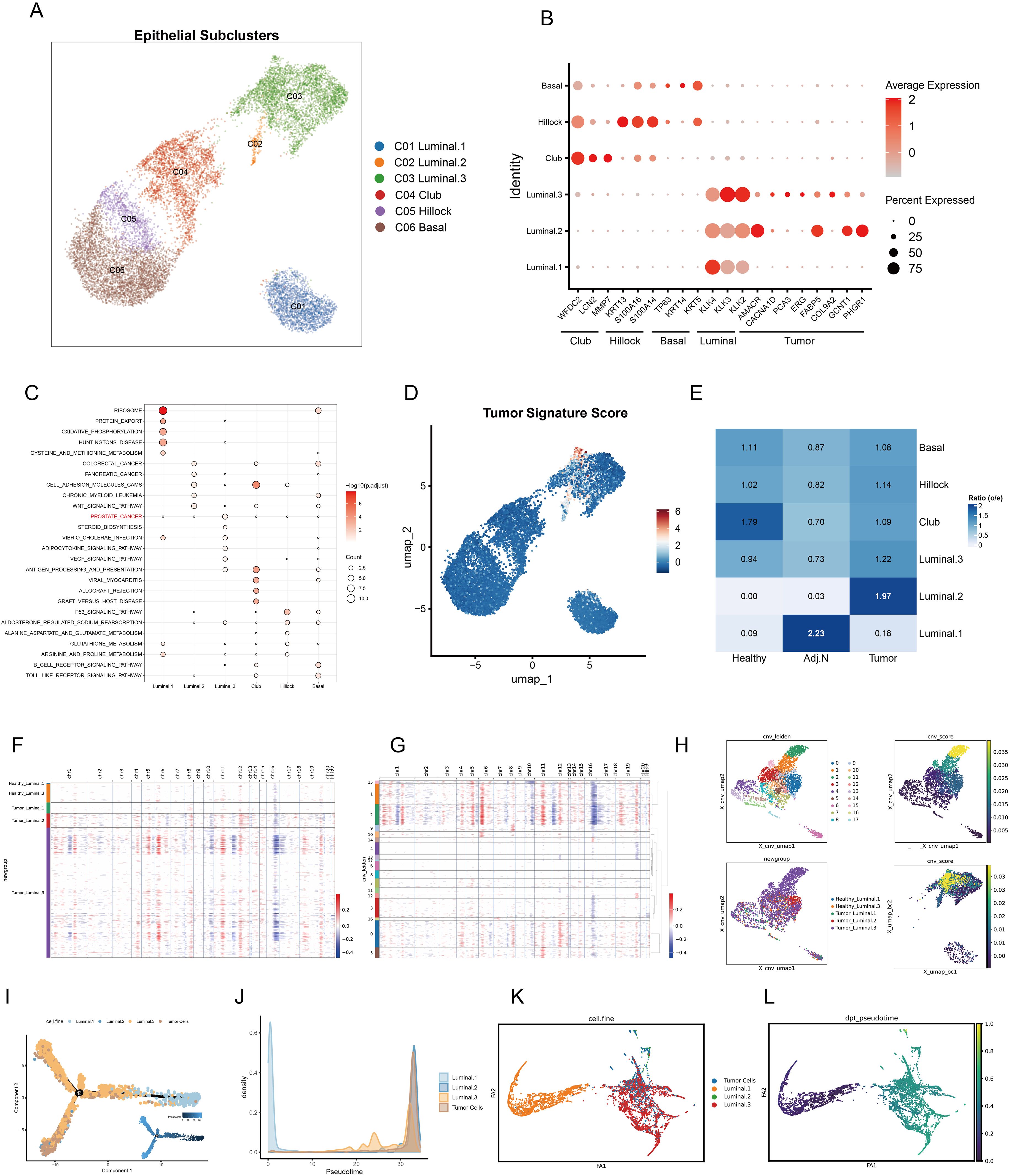 A composite of various data visualizations related to epithelial subclusters. Panel A displays a visualization of six different epithelial subclusters with distinct colors and labels. Panel B is a bubble plot indicating average expression and percentage expressed across identities. Panel C presents a dot plot of gene sets with expression levels. Panel D shows a UMAP plot indicating tumor signature scores. Panel E presents a heatmap comparing health, adjacencies, and tumor conditions. Panels F and G depict heatmaps of gene expressions. Panel H contains multiple UMAP plots showing cluster distinctions. Panel I is a trajectory plot of different cell states. Panel J is a density plot showing cell cycle phases. Panels K and L show trajectory and pseudotime UMAP plots.