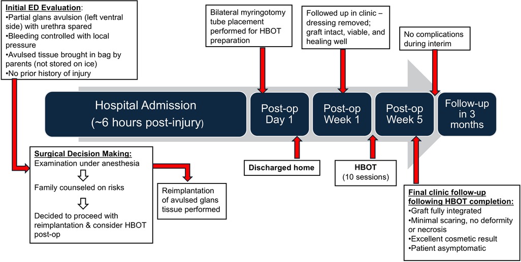Flowchart summarizing the clinical timeline of a pediatric case involving partial glans avulsion. The chart begins with emergency department evaluation six hours post-injury, followed by surgical decision-making, reimplantation, and a series of hyperbaric oxygen therapy (HBOT) sessions. Postoperative progress is marked at day one, week one, and week five, with a final three-month follow-up showing successful graft integration and minimal scarring.