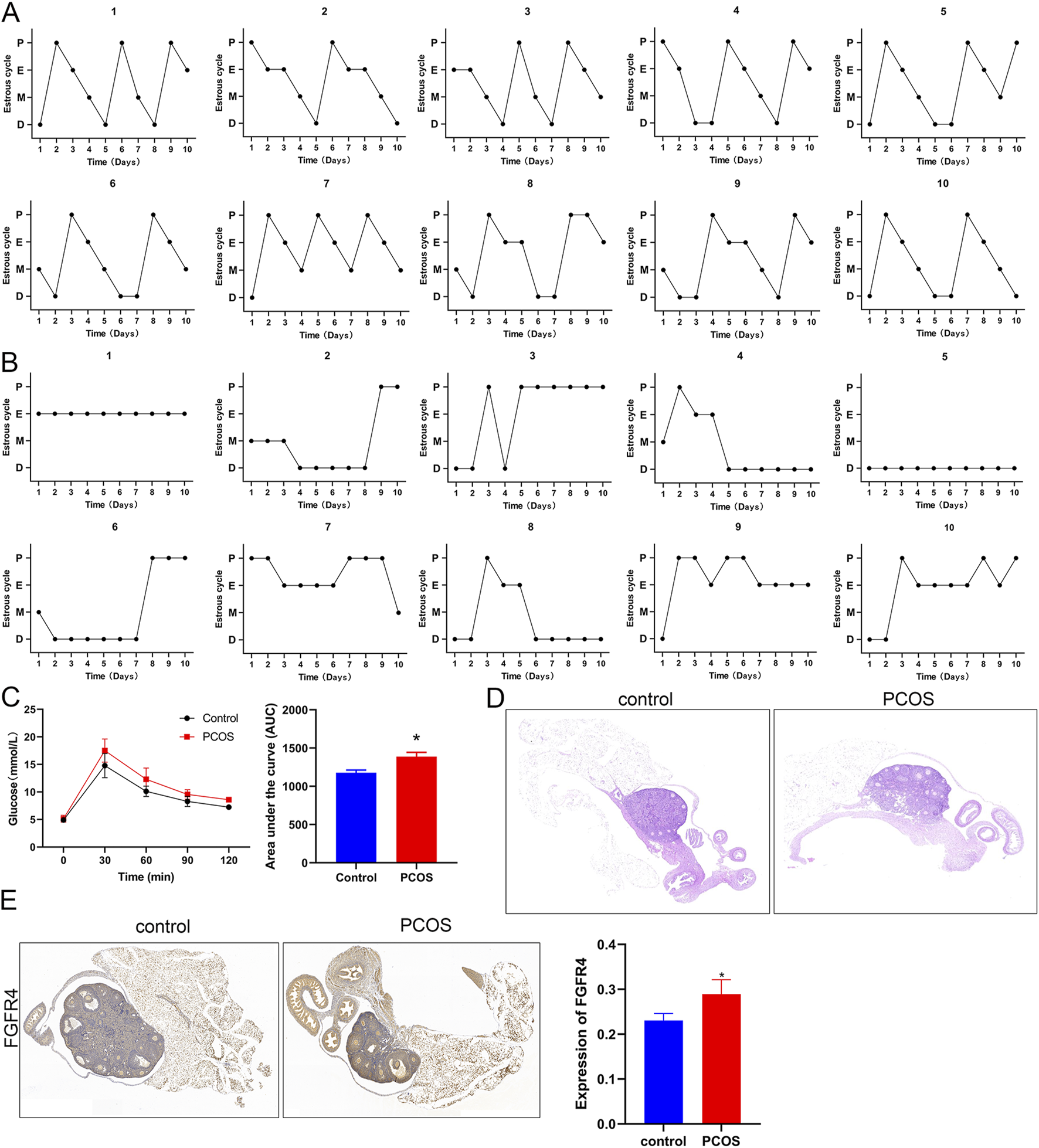 Graphs and histological images compare control and PCOS conditions. Panels A and B show cyclical estrous stages across ten days, with distinct fluctuations in controls (A) and reduced variation in PCOS (B). Panel C presents glucose levels over time, with area under the curve differences, highlighting elevated levels in PCOS subjects. Panel D shows histological sections of control and PCOS tissues. Panel E displays FGFR4 expression in tissues, with a bar graph indicating increased expression in PCOS compared to control.