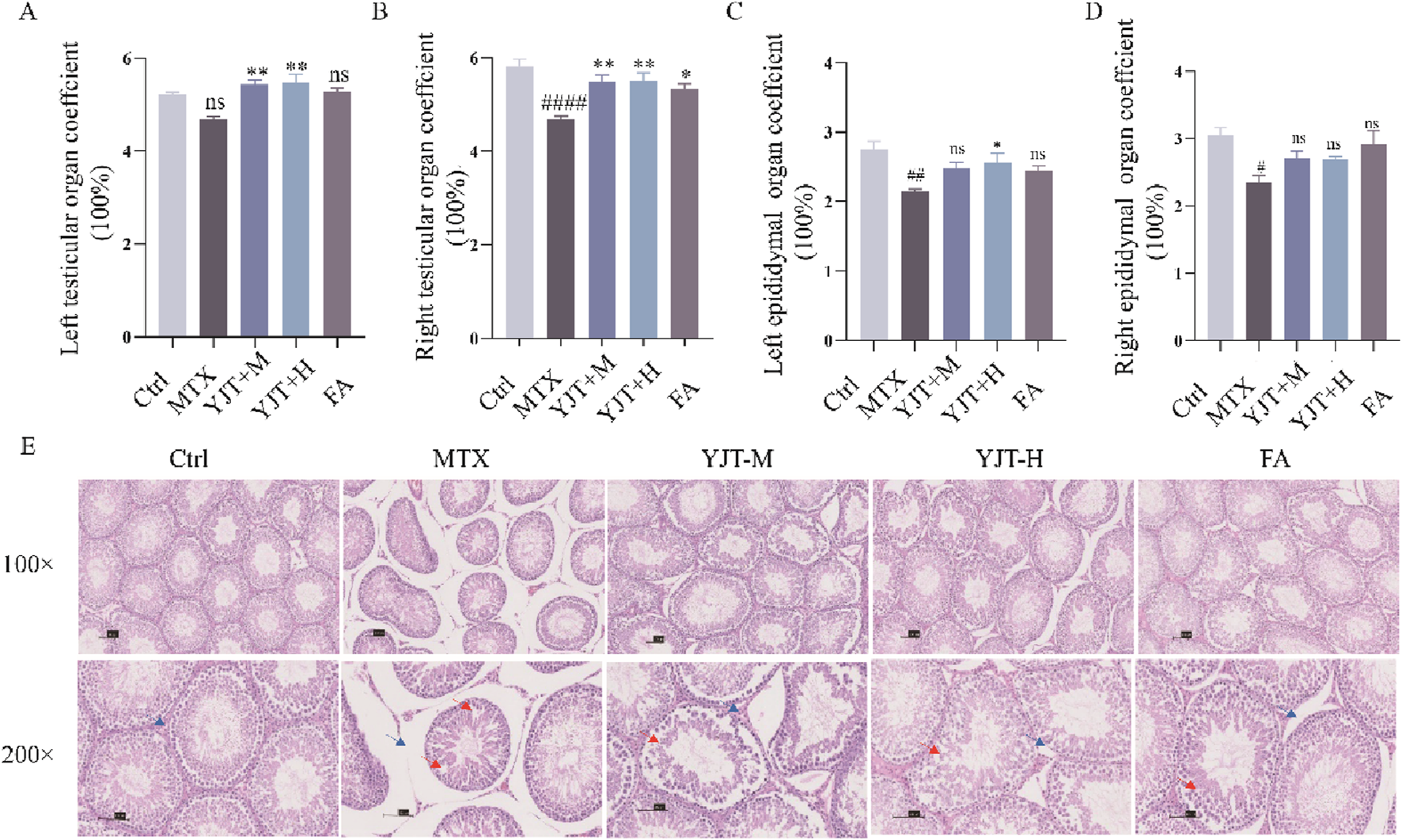 Bar charts and histological images illustrate organ coefficients and tissue samples. Panels A-D show left and right testicular and epididymal organ coefficients for different treatments: Ctrl, MTX, YJT+M, YJT+H, FA. Panel E shows histology at 100x and 200x magnification for each treatment. Statistical significance is marked on the charts.