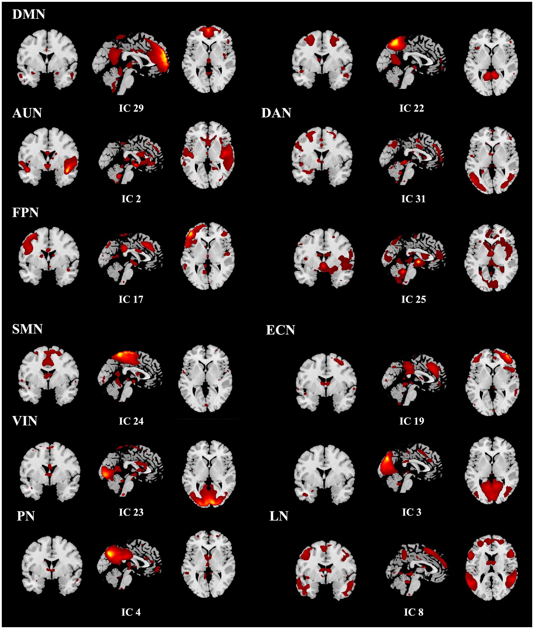 Brain imaging scan featuring multiple sections labeled by networks, such as DMN, AUN, DAN, FPN, SMN, ECN, VIN, PN, and LN. Each section contains individual images identified as IC numbers, with highlighted areas in red indicating active regions. The images display varying brain views, including axial and sagittal planes.