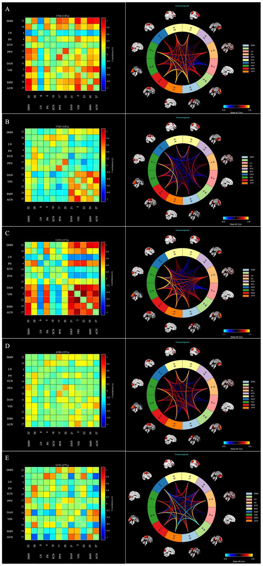 Five panels labeled A to E, each containing two visualizations: a correlation matrix on the left and a connectogram on the right. The matrices display correlations between various brain networks, highlighting differences in connectivity. The connectograms illustrate the network connections using colors and lines, with surrounding brain images corresponding to the network locations. Each panel features a similar layout with variations in color intensity and connection patterns, indicated by different color scales and line thickness.