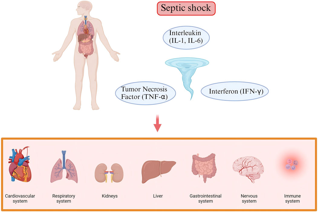 Illustration depicts septic shock affecting various body systems. A human figure shows internal organs with labels: Interleukin (IL-1, IL-6), Tumor Necrosis Factor (TNF-α), and Interferon (IFN-γ). Arrows indicate impact on the cardiovascular, respiratory, kidney, liver, gastrointestinal, nervous, and immune systems.