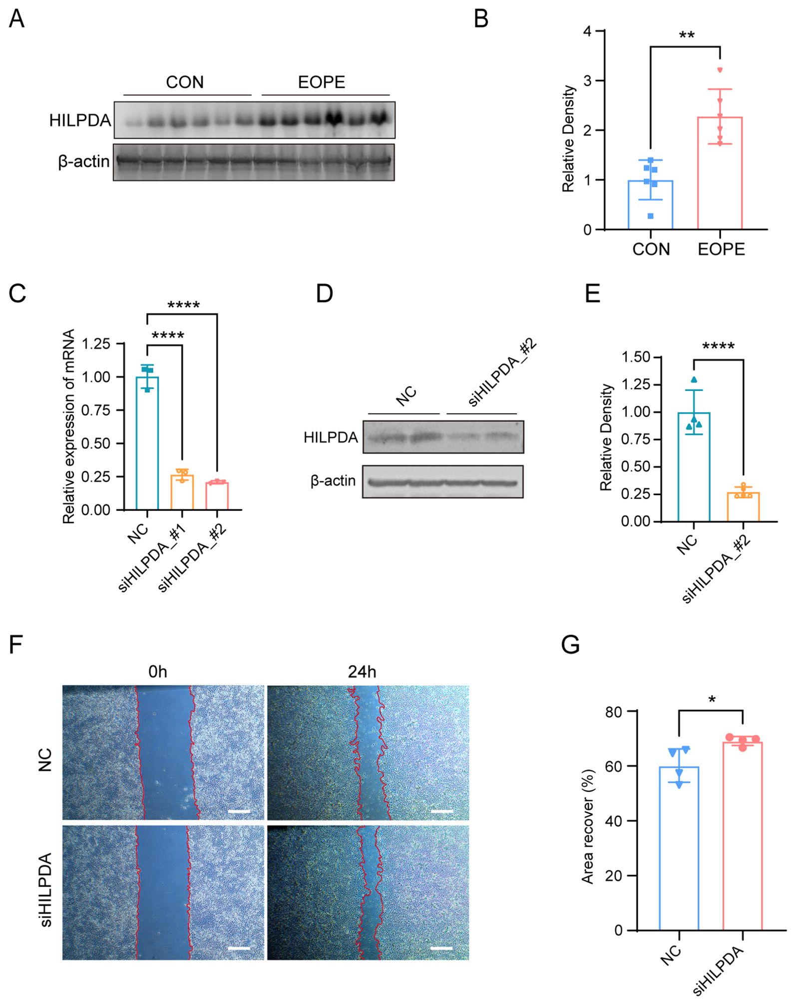 A collage of scientific data includes several panels: A) Western blot showing HILPDA and β-actin levels for control (CON) and EOPE samples. B) Bar graph showing relative density with a significant difference between CON and EOPE. C) Bar graph indicating relative mRNA expression for NC and siHILPDA samples, with significant differences. D) Another Western blot for HILPDA and β-actin comparing NC and siHILPDA. E) Bar graph of relative density, showing a significant decrease for siHILPDA. F) Microscopy images of wound healing assay at 0 and 24 hours for NC and siHILPDA, indicating different recovery rates. G) Bar graph of area recovery percentage, showing a significant difference between NC and siHILPDA.