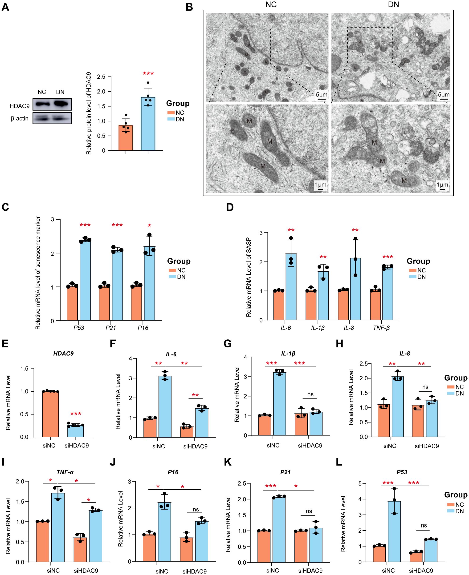 Panel A shows a Western blot and bar graph comparing HDAC9 protein levels in NC and DN groups. Panel B includes electron microscopy images of cellular structures, with mitochondria labeled as “M”. Panel C presents a bar graph of mRNA levels for senescence markers P53, P21, and P16 in NC and DN. Panel D shows relative mRNA levels of SASP markers IL-6, IL-1β, IL-8, and TNF-β. Panels E to L display bar graphs comparing mRNA levels of HDAC9, IL-6, IL-1β, IL-8, TNF-α, P16, P21, and P53 between siNC and siHDAC9 conditions. Statistical significance is indicated with asterisks.