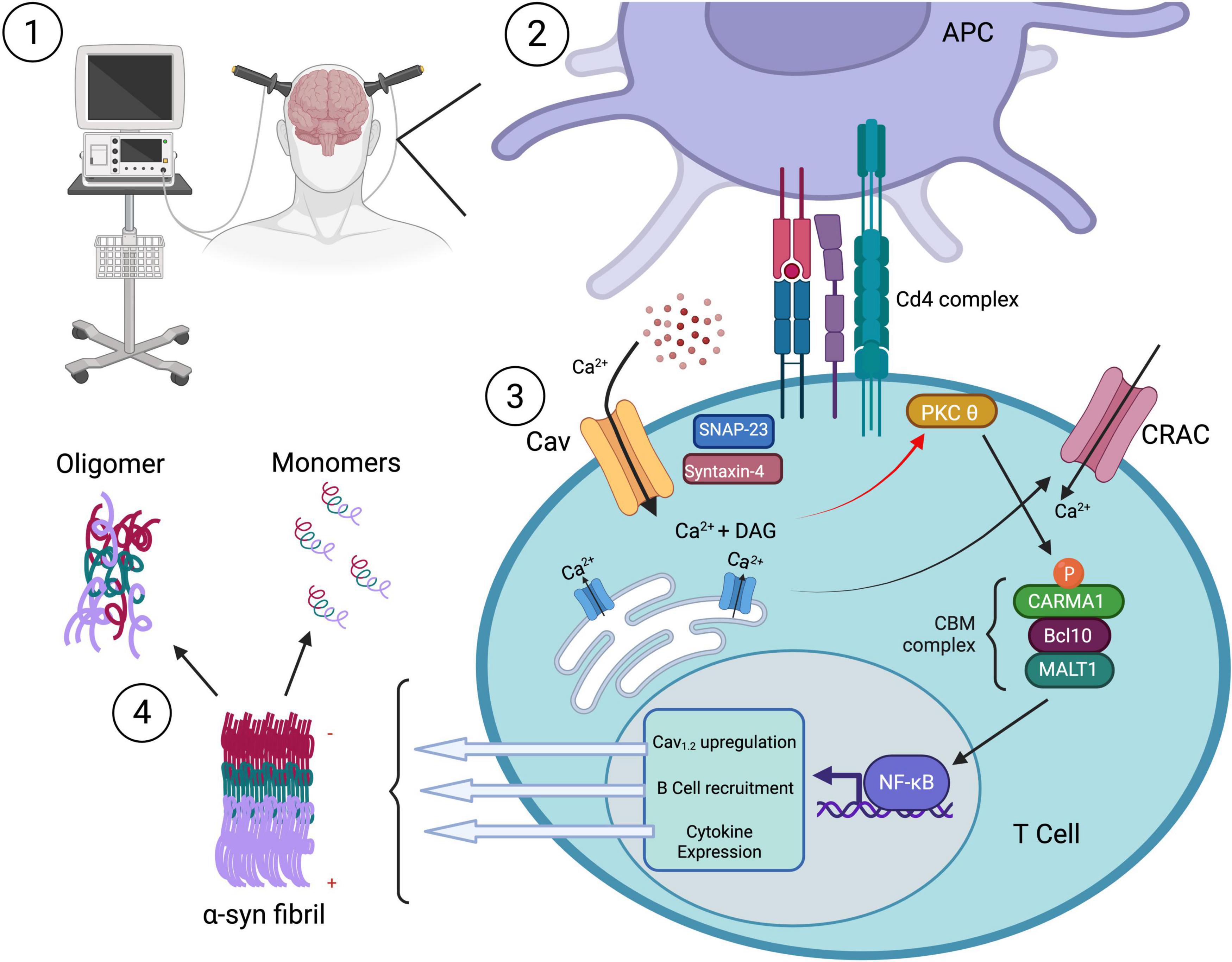 Diagram illustrating the effects of neuromodulation on T cell signalling and alpha-synculein clearance. It shows: 1) a person with neuromodulatory equipment connected to the head; 2) an antigen-presenting cell (APC) with a Cd4 complex; 3) intracellular T cell pathways involving Ca2?, DAG, and PKC?; 4) Conformational changes in alpha-synuclein from toxic fibrils to monomers and oligomers, potentially reflecting enhanced clearance or reduced aggregation.