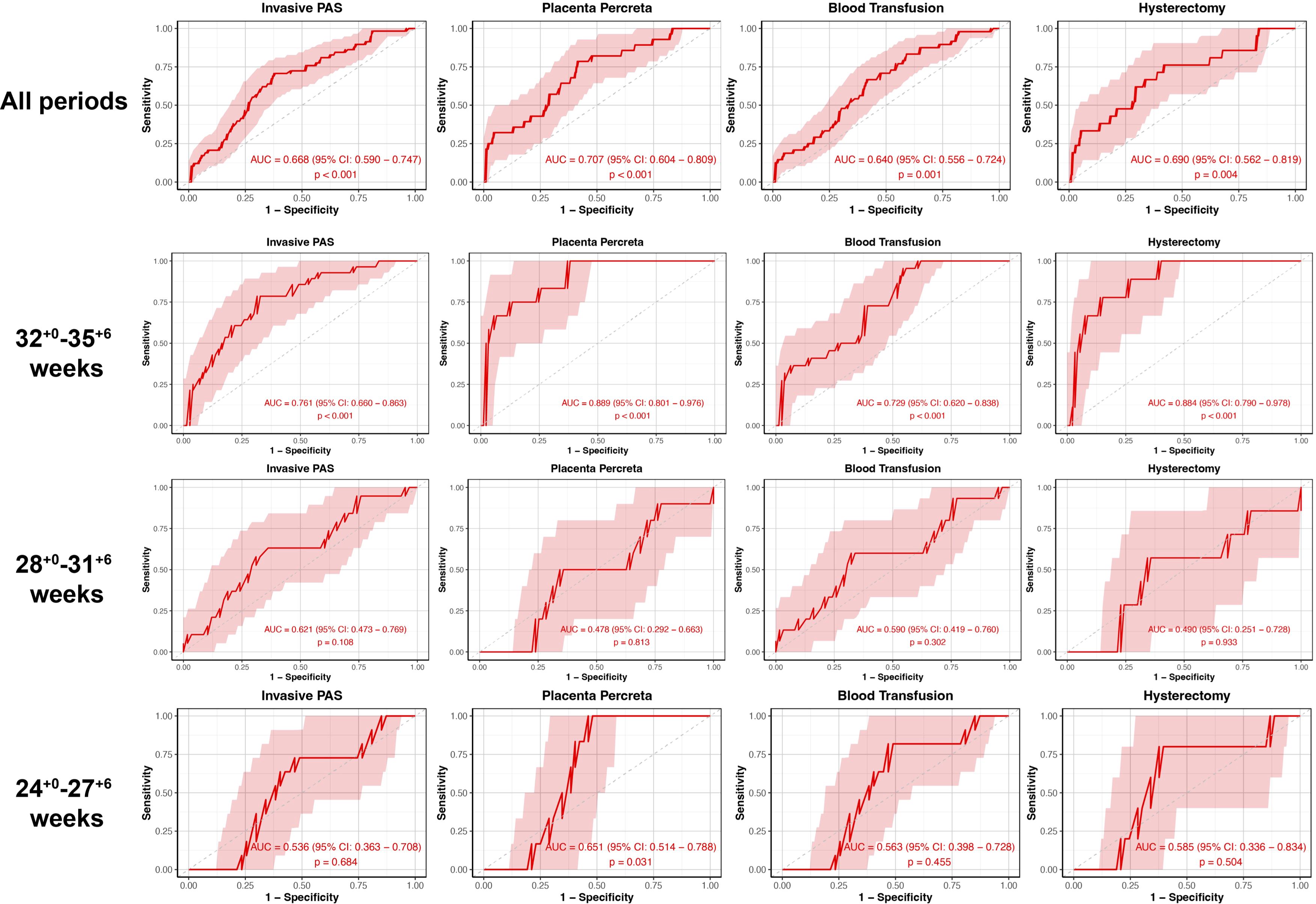 Receiver Operating Characteristic (ROC) curves for four medical conditions across different gestational periods. Each chart displays sensitivity versus 1-specificity for conditions: Invasive PAS, Placenta Percreta, Blood Transfusion, and Hysterectomy. Rows represent overall and specific weeks (32\(^0\)-35\(^+6\), 28\(^0\)-31\(^+6\), 24\(^0\)-27\(^+6\)). AUC values and corresponding confidence intervals, with significance levels, are shown for each curve. Red shaded areas indicate confidence regions.