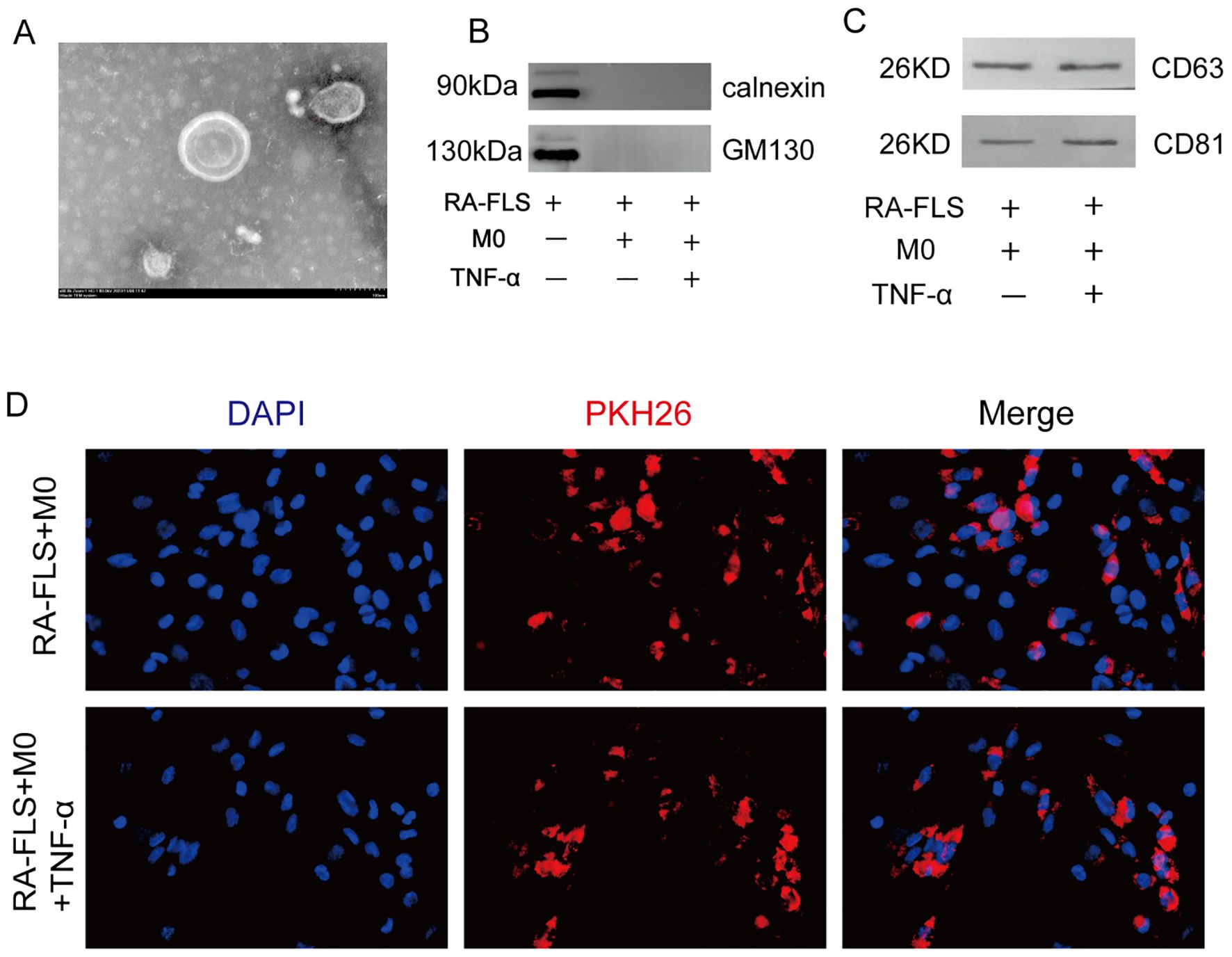 Electron microscopy and Western blot images show extracellular vesicles and protein expressions in RA-FLS. Panel A displays extracellular vesicles. Panel B shows calnexin and GM130 protein expressions in lanes for RA-FLS, with or without M0 macrophages and TNF-alpha. Panel C shows protein expressions of CD63 and CD81. Panel D shows fluorescence microscopy of RA-FLS with M0 macrophages, stained with DAPI and PKH26. Blue indicates nuclei, and red indicates vesicles, with merged images showing overlap. Two conditions are presented: RA-FLS with M0 and RA-FLS with M0 plus TNF-alpha.