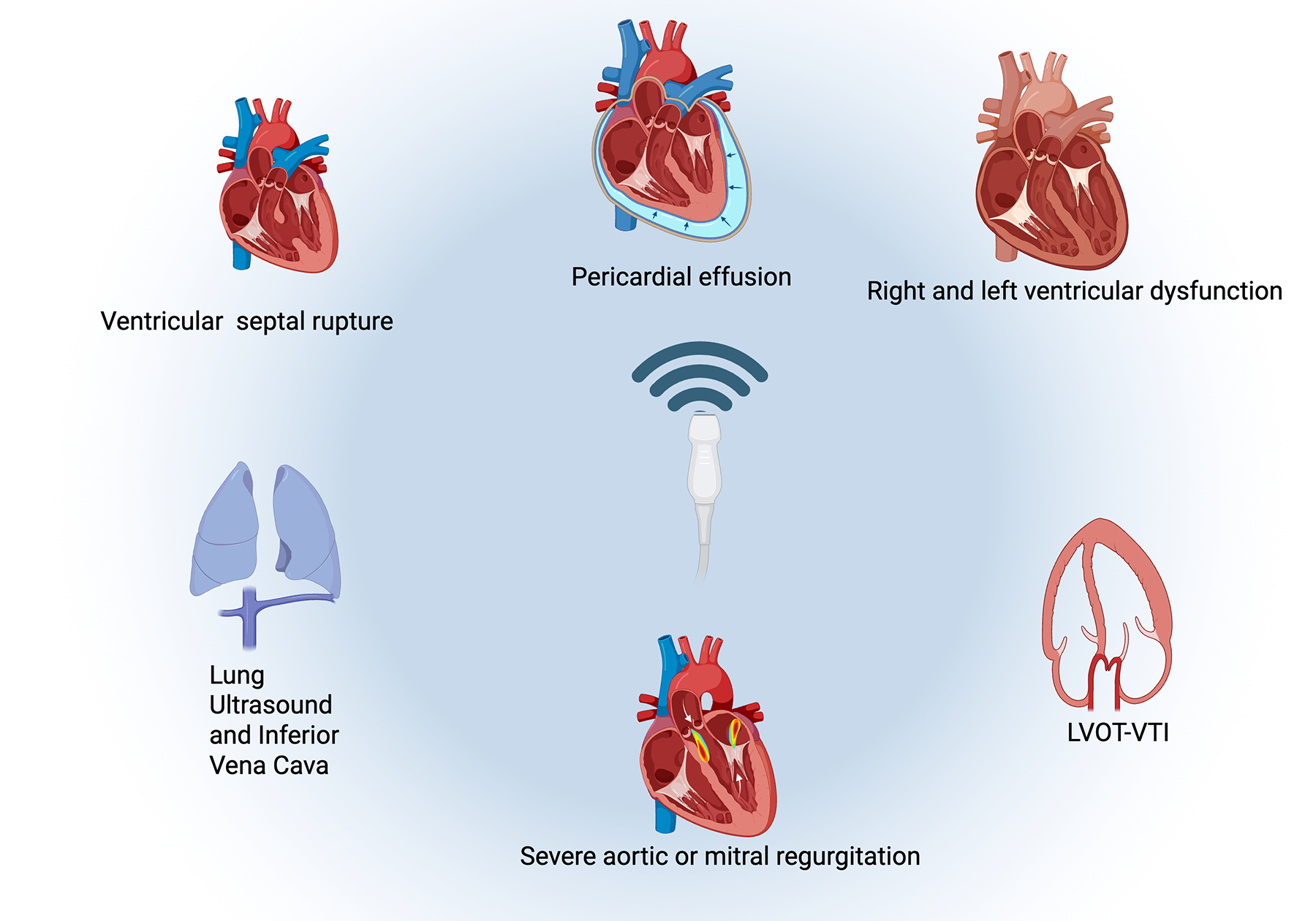 Diagram showing a central human heart with ultrasound waves, connected by arrows to images illustrating associated conditions. These include lung ultrasound and inferior vena cava, LVOT VTI, pericardial effusion, severe aortic or mitral regurgitation, ventricular septal rupture, and right and left ventricular dysfunction. Each condition is labeled beneath its respective image.
