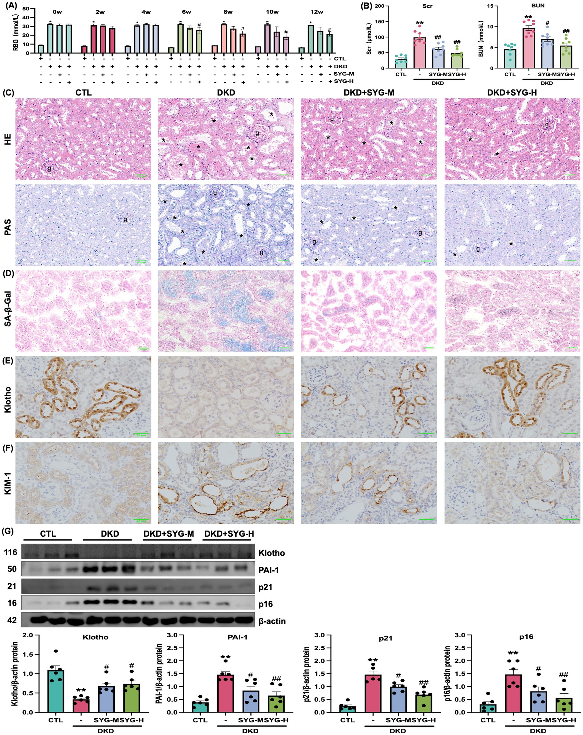 Charts and histological images illustrate research on diabetic kidney disease (DKD) treatment effects. (A) and (B) show bar graphs of biochemical markers. (C) to (F) present kidney tissue stained with different methods showing morphological changes. (G) displays a western blot analysis and related bar charts for protein expression, including Klotho and PAI-1, under different conditions like CTL, DKD, and treatments with SYG.