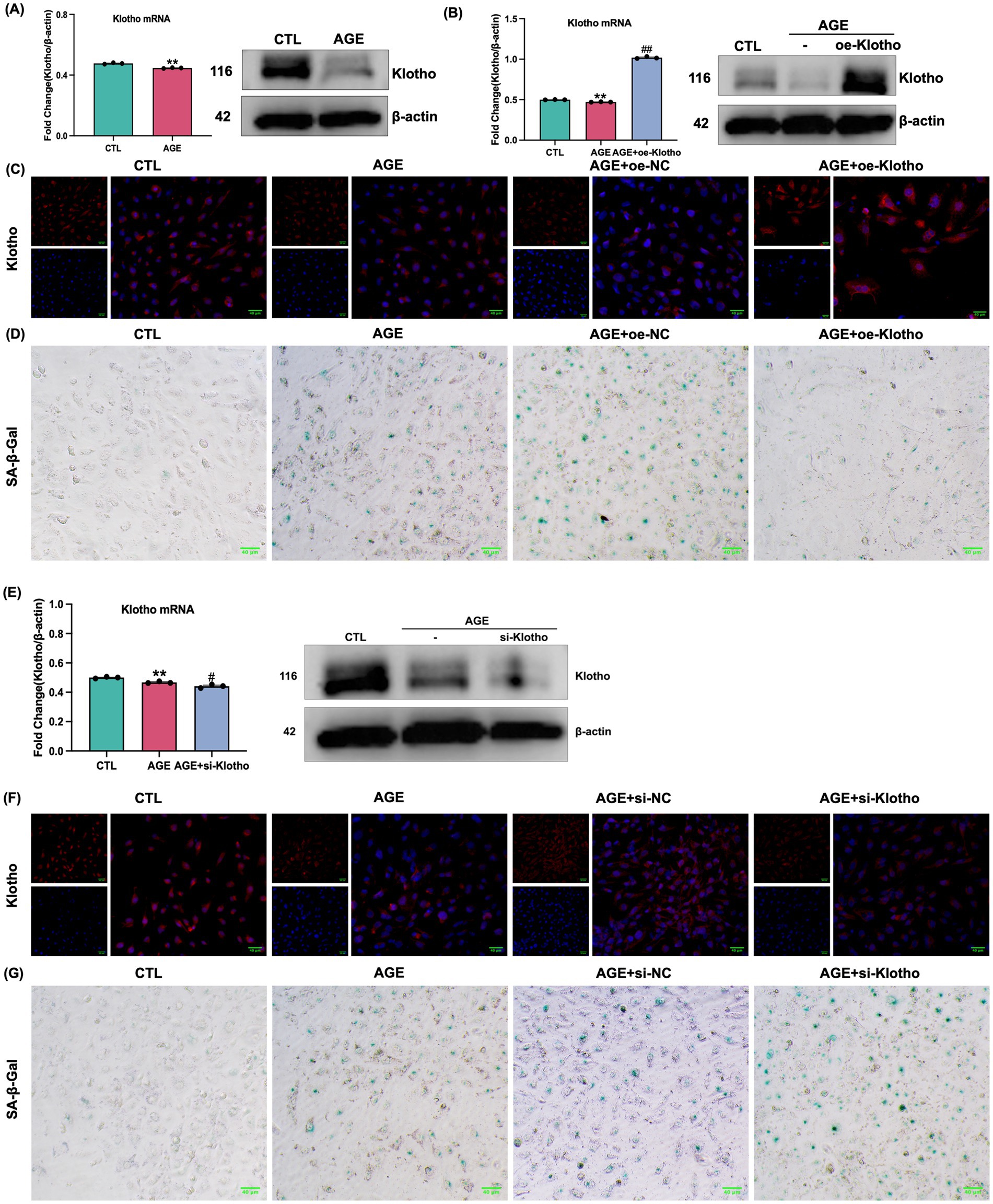 Graphs and images illustrate the effects of Klotho expression on cell senescence. Panels (A, B, E) show bar graphs and Western blots comparing Klotho mRNA and protein levels in different treatment groups. Panels (D) and (G) display SA-β-gal staining images indicating senescence levels in cells. Panels (C) and (F) present immunofluorescence images showing Klotho protein localization. The data highlight differences in gene expression and cellular senescence among control (CTL), AGE-treated, and Klotho-modified groups.