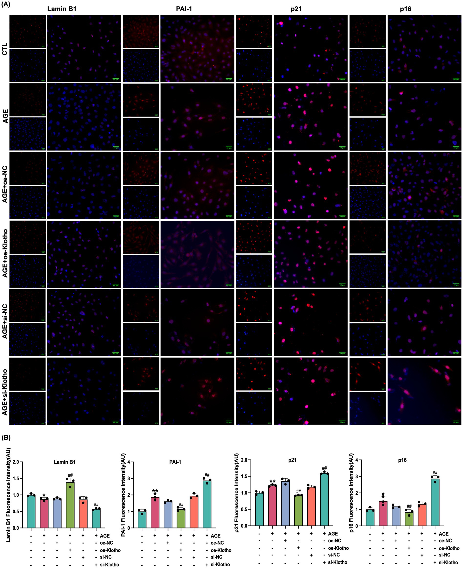 (A) A series of fluorescence microscopy images showing the expression of proteins Lamin B1, PAI-1, p21, and p16 across different conditions: CTL, AGE, AGE+oe-NC, AGE+oe-Klotho, AGE+si-NC, and AGE+si-Klotho. Each row represents a specific condition, and columns represent different proteins. Nuclei are stained blue, proteins are shown in red or pink. (B) Four bar graphs displaying quantitative analysis of protein expression levels for Lamin B1, PAI-1, p21, and p16 under the same conditions as in the microscopy images, with varying expression levels indicated by bar heights and statistical annotations.