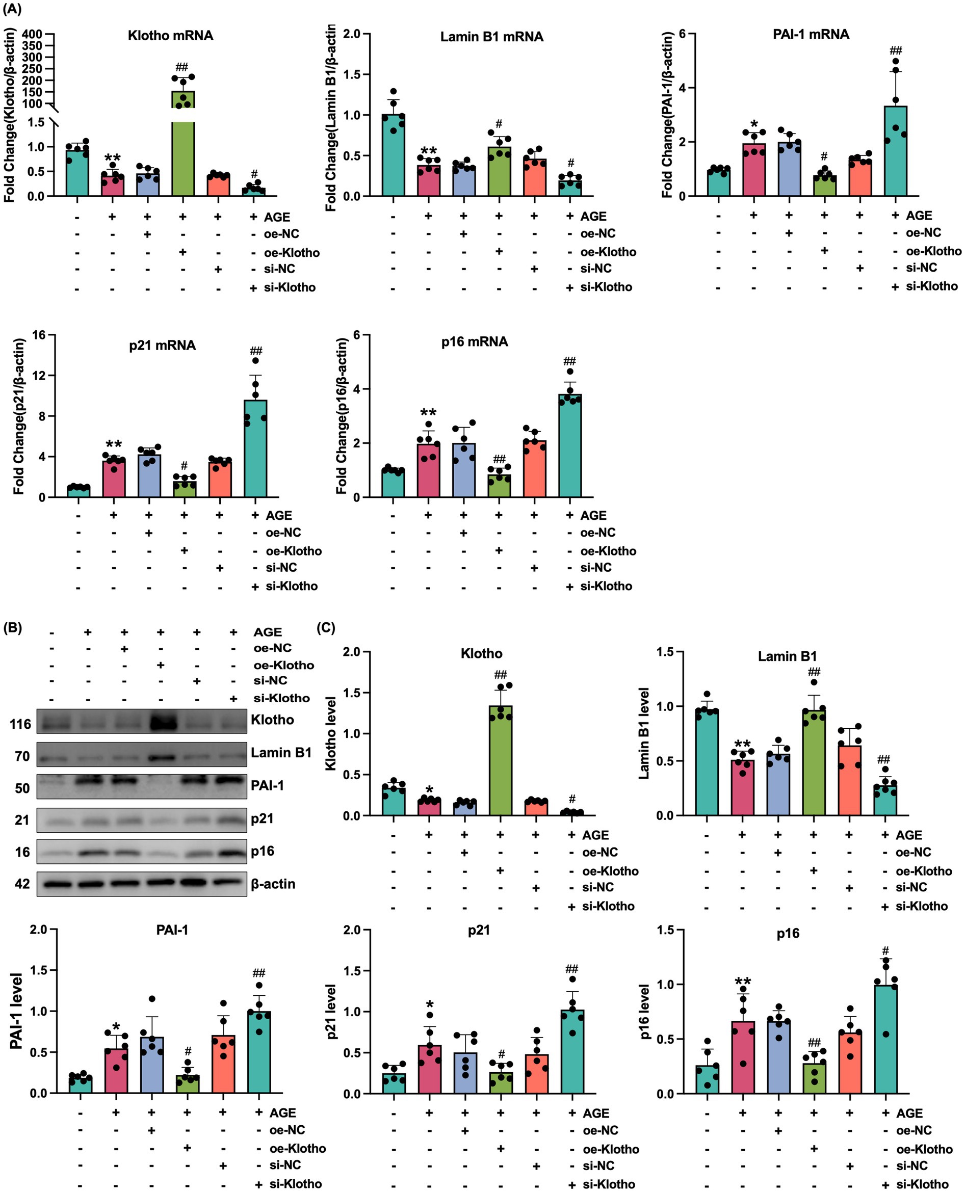 Bar charts and Western blot results depict the effects of different treatments on gene and protein expression levels. (A) Bar charts show fold changes in mRNA levels of Klotho, Lamin B1, PAI-1, p21, and p16 under various conditions. (B) Western blot images display protein bands for Klotho, Lamin B1, PAI-1, p21, p16, and β-actin. (C) Corresponding bar charts illustrate protein level changes for the same factors, highlighting differential expression with significance indicated by symbols.