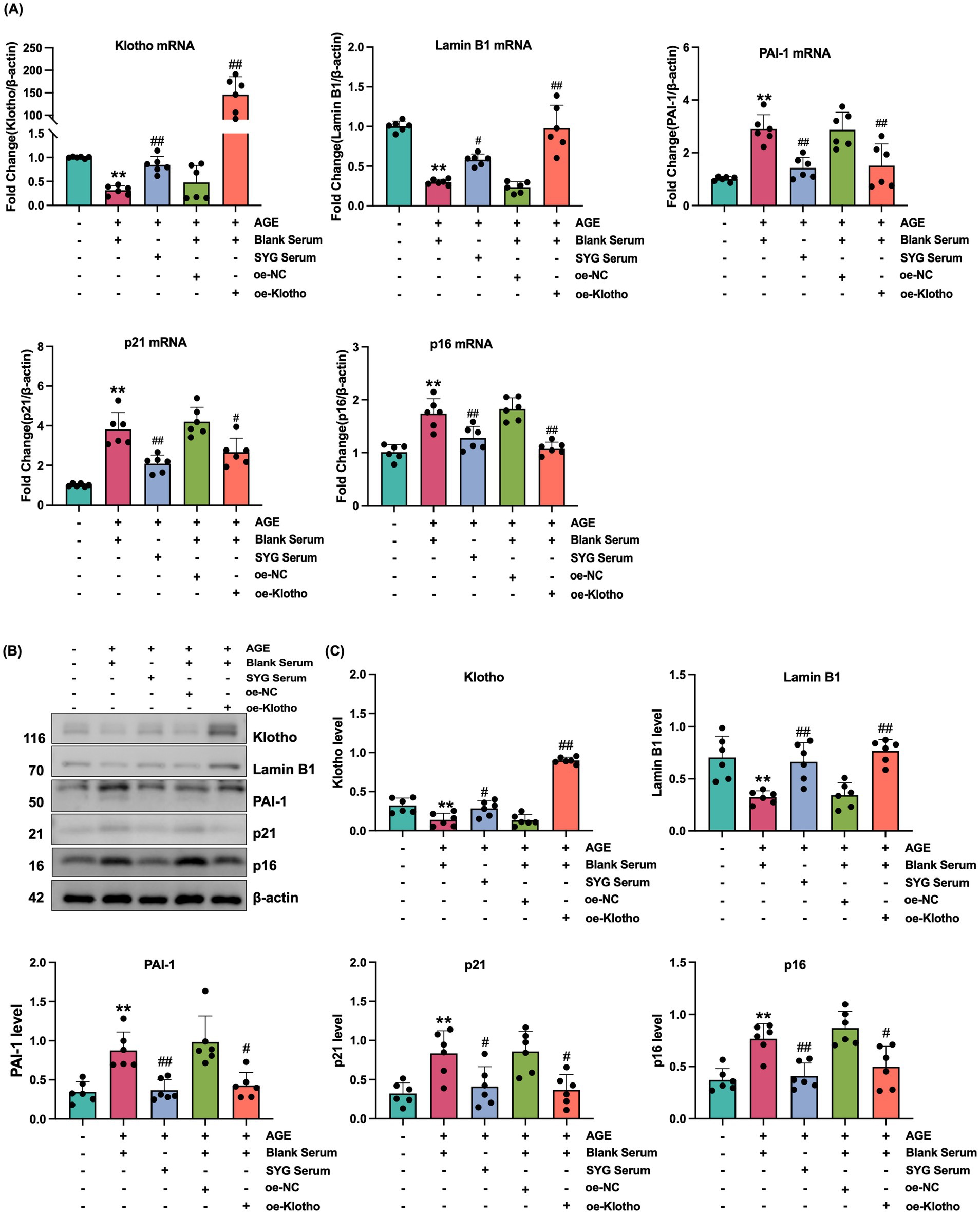 Bar graphs and a Western blot image depict the effects of various treatments on gene expression and protein levels. Panel A displays mRNA fold changes for Klotho, Lamin B1, PAI-1, p21, and p16, indicating alterations with AGE, blank serum, SYG serum, oe-NC, and oe-Klotho. Panel B shows a Western blot analysis of corresponding proteins with β-actin as a control. Panel C presents bar graphs for protein levels derived from the blot, demonstrating changes under different conditions, similar to Panel A. Each treatment condition is marked with symbols indicating statistical significance.