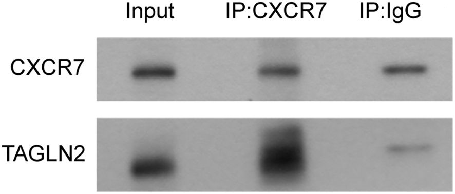 Western blot showing protein bands for CXCR7 and TAGLN2. Three lanes labeled Input, IP:CXCR7, and IP:IgG. The CXCR7 band appears in all lanes, while TAGLN2 shows strong presence in the IP:CXCR7 lane and faint presence in others.