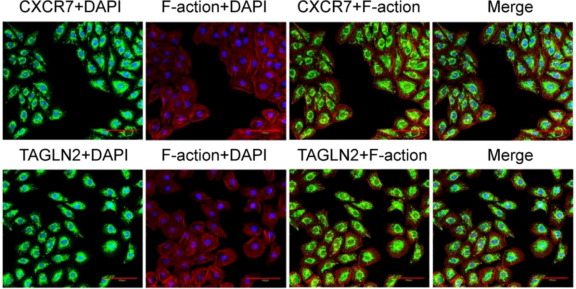 Microscopy images showing cellular staining in two rows. The top row displays CXCR7 with DAPI, F-action with DAPI, CXCR7 with F-action, and a merged image. The bottom row shows TAGLN2 with DAPI, F-action with DAPI, TAGLN2 with F-action, and a merged image. Green represents CXCR7 or TAGLN2, red is F-action, and blue indicates DAPI-stained nuclei.