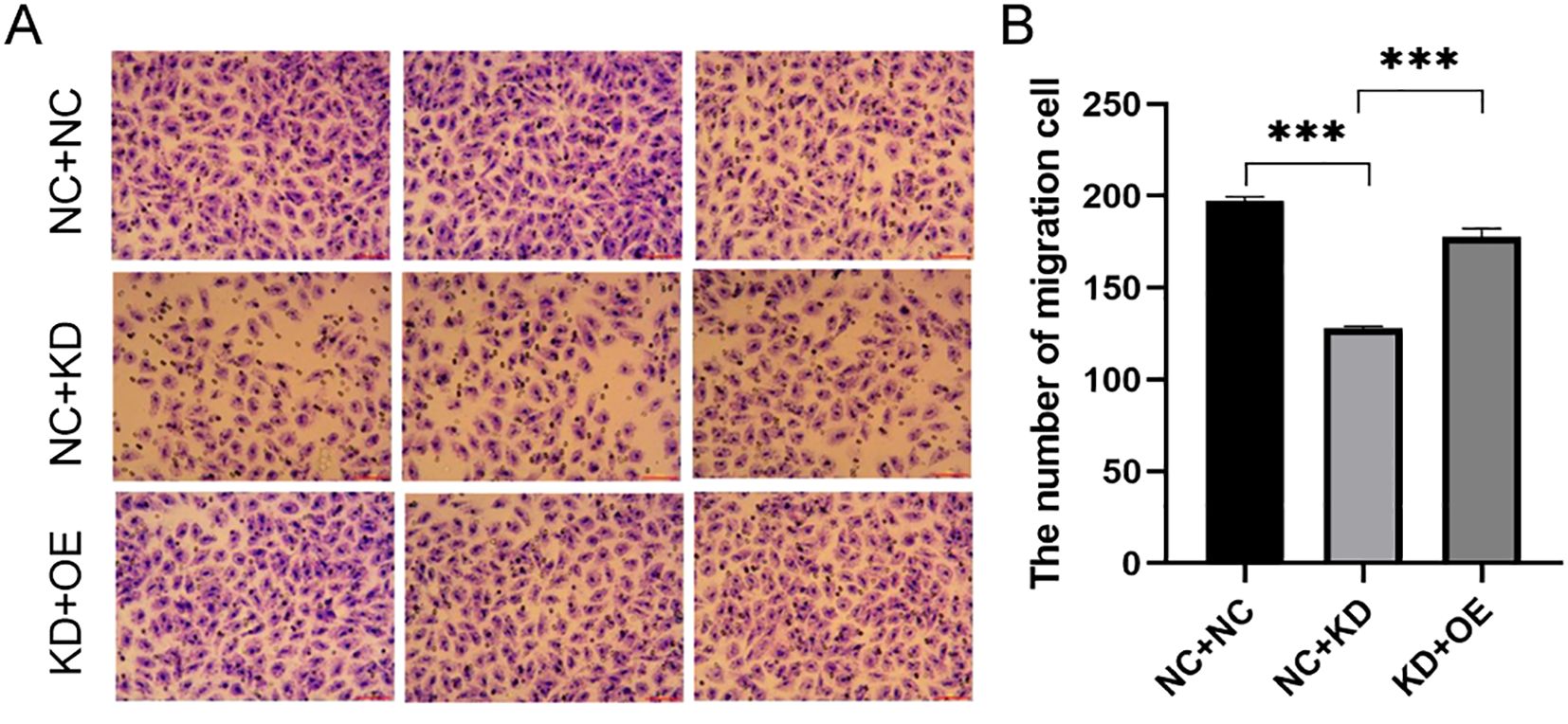 Panel A shows microscopic images of cells with different treatments: NC+NC, NC+KD, and KD+OE, each in three repeats. Panel B displays a bar graph comparing the number of migrating cells for each treatment, with NC+NC showing the highest cell migration, followed by KD+OE, and then NC+KD. Statistical significance is indicated by asterisks.