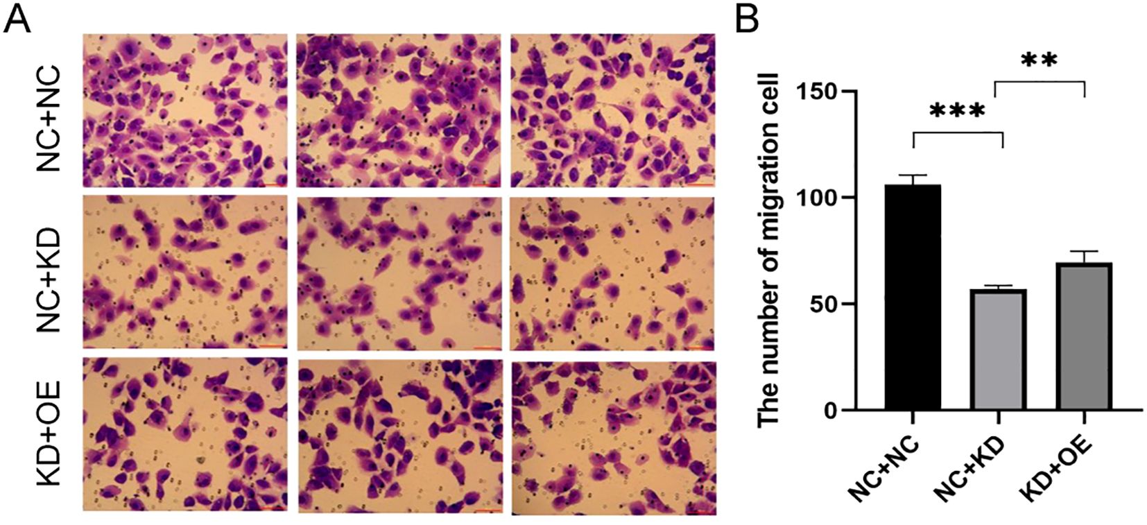 Panel A shows microscopic images of cells stained in purple, comparing groups labeled NC+NC, NC+KD, and KD+OE. Panel B is a bar graph displaying the number of migrating cells for these groups, with NC+NC having the highest mean cell count, followed by KD+OE, and NC+KD. Statistically significant differences are indicated by asterisks.