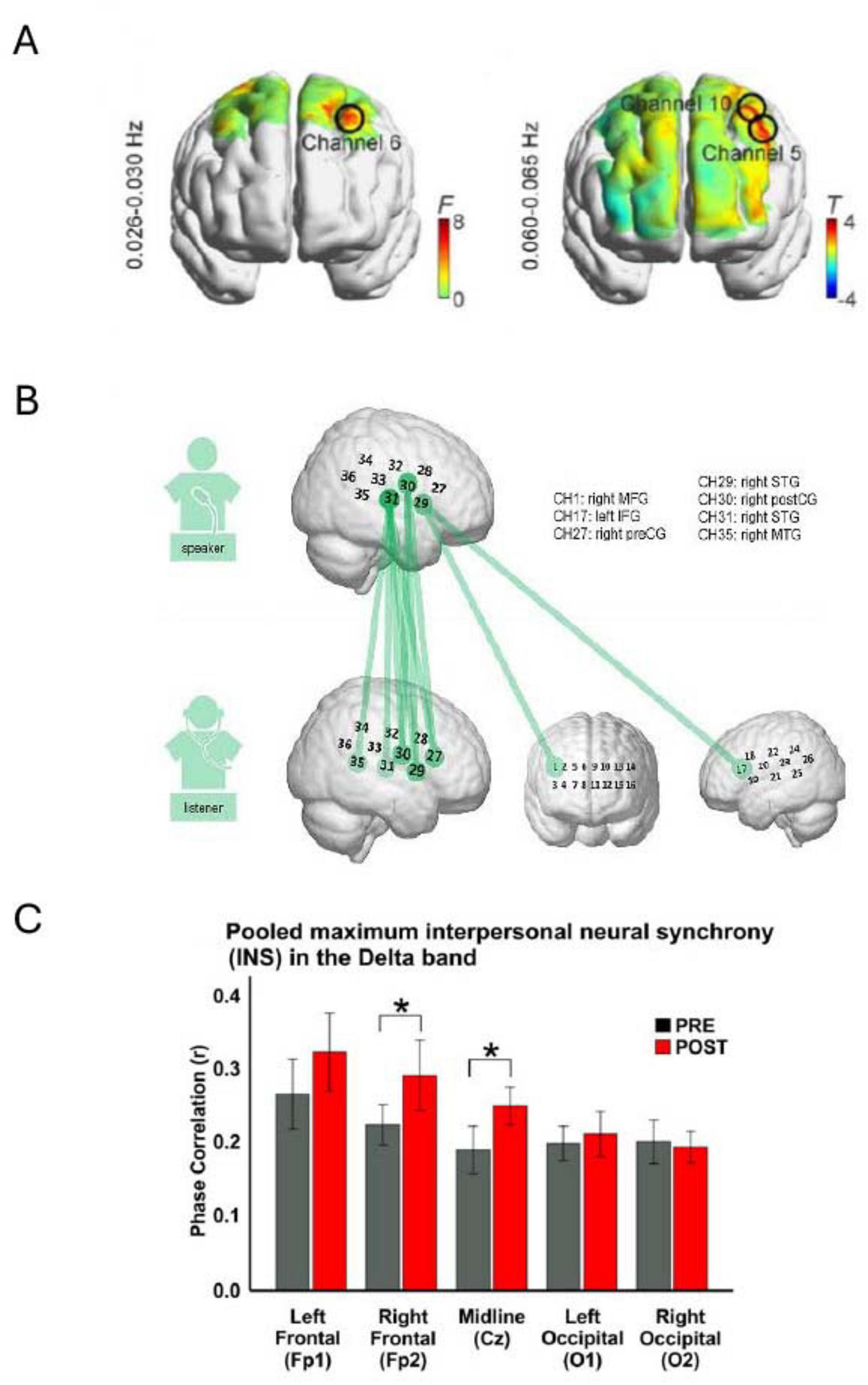 Diagram with three panels: A, B, and C. Panel A shows brain activity maps with marked channels indicating frequencies. Panel B illustrates neural connections between a speaker and listener, indicating specific brain regions like right MFG, left IFG, and others. Panel C displays a bar graph comparing pre and post conditions of interpersonal neural synchrony in the Delta band across different brain regions, denoting significant changes with asterisks.