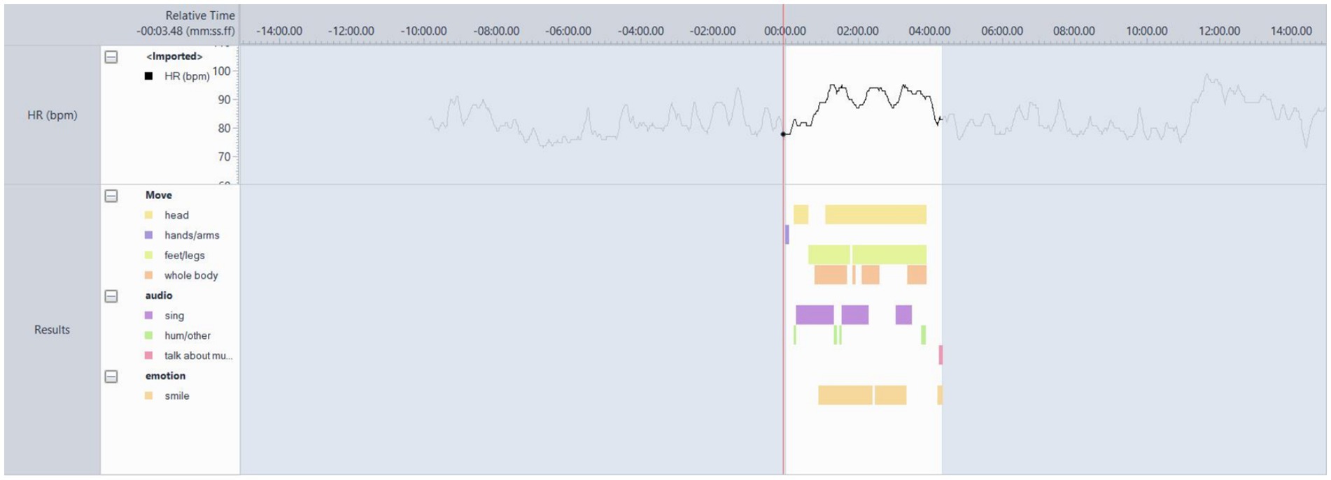Graph showing heart rate in beats per minute over a timeline, with movements, audio, and emotions indicated by colored blocks. Blocks represent head movement, singing, and smiling.