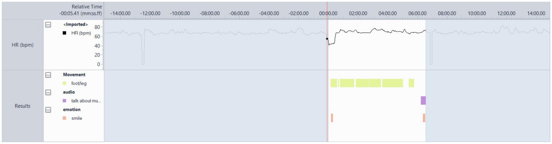 Graph displaying heart rate data over time with lines showing relative time from negative to positive values. It includes indicators for movement (foot and leg), audio (talk about music), and emotion (smile) aligned to the timeline.