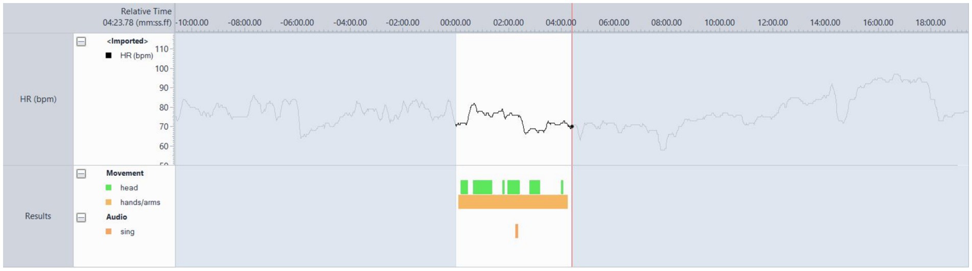 Graph displaying heart rate in beats per minute over time, with movement and audio results. The time scale spans from negative to positive. Heart rate fluctuates between 60 and 110. Movement is indicated by green and orange bars for head and hands/arms, and audio by orange bars for singing.