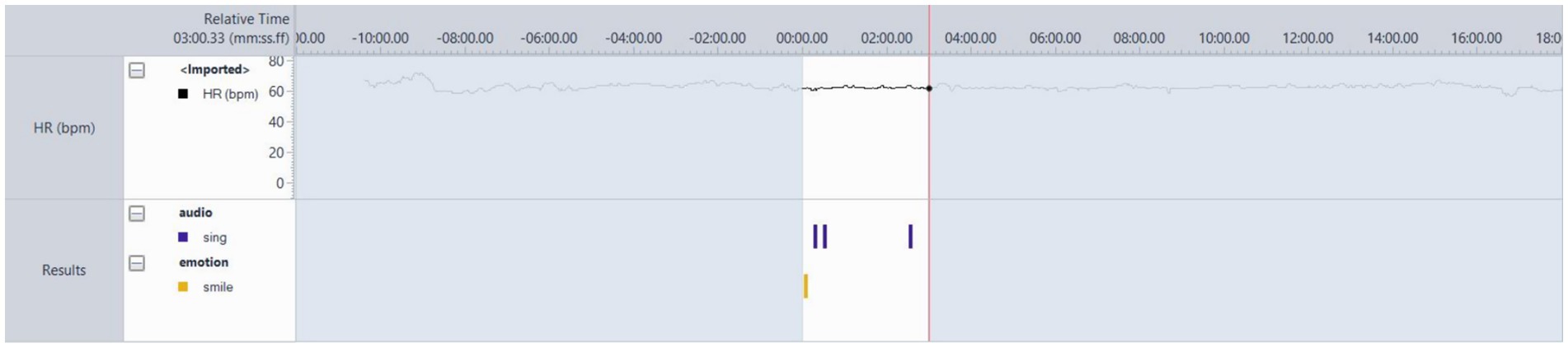 A graph displaying heart rate (HR) over time, with values mostly around 65 beats per minute. Sections are marked with audio and emotion annotations: purple bars indicate singing and yellow bars indicate smiling. The time is shown from three minutes before to eighteen minutes after a zero reference point.