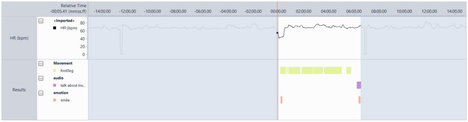 Graph displaying heart rate data over time with lines showing relative time from negative to positive values. It includes indicators for movement (foot and leg), audio (talk about music), and emotion (smile) aligned to the timeline.