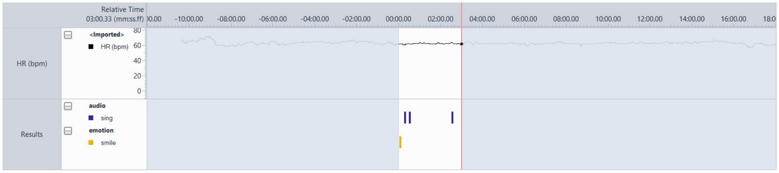 A graph displaying heart rate (HR) over time, with values mostly around 65 beats per minute. Sections are marked with audio and emotion annotations: purple bars indicate singing and yellow bars indicate smiling. The time is shown from three minutes before to eighteen minutes after a zero reference point.