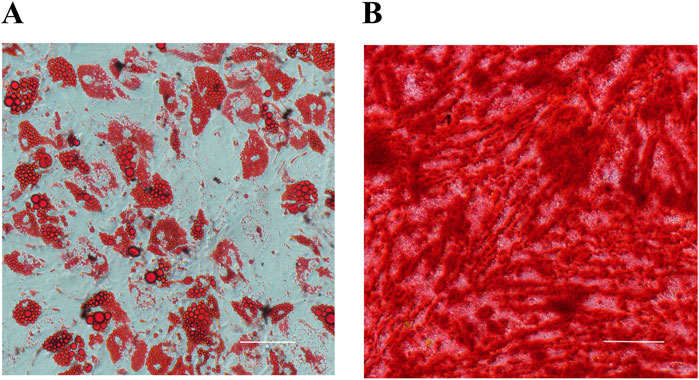 Panel A shows a microscopic image of adipocytes stained with red lipid droplets dispersed in a blue matrix. Panel B displays a dense network of fibrous red tissue, indicating collagen fibers, with a uniform red texture. Both panels include a scale bar for reference.