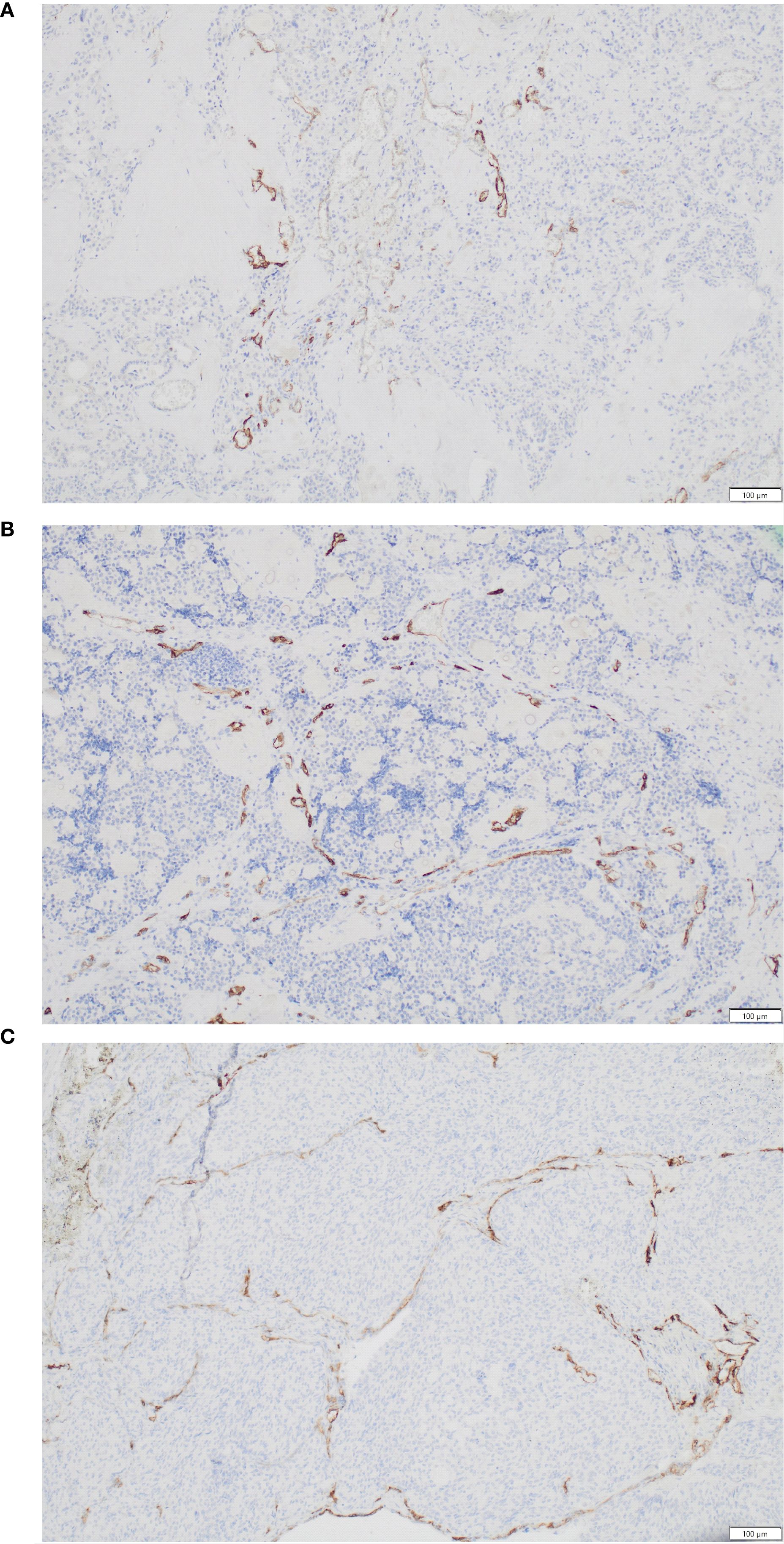 Three panels labeled A, B, and C show histological tissue samples stained to highlight specific structures. Darker brown areas indicate regions of interest within a lighter, more diffuse background. Each panel displays different patterns and densities of the stained regions, suggesting variations in tissue characteristics. Scale bar indicates 100 micrometers.