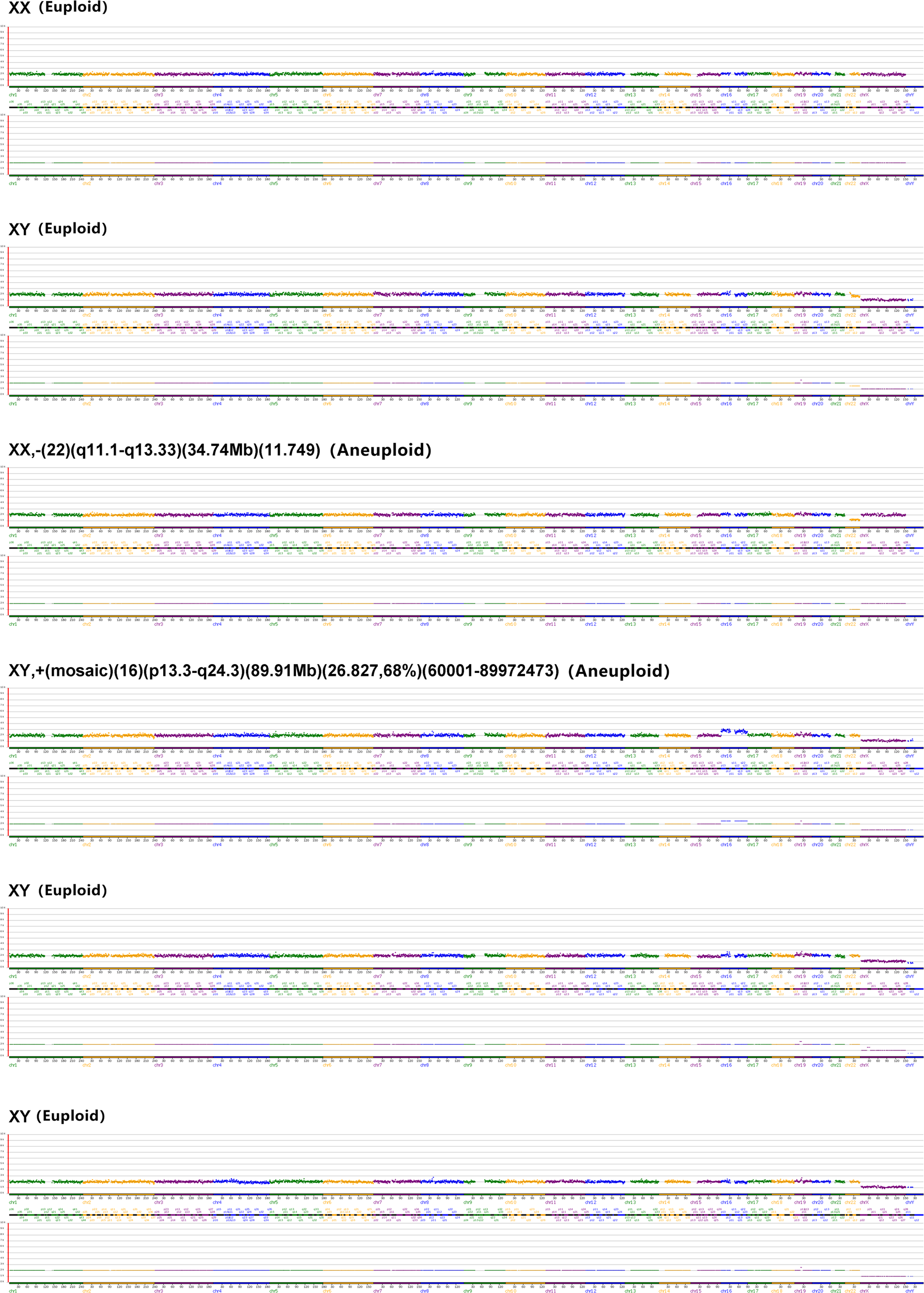 Genomic plots displaying genetic data for different chromosomal arrangements. The first and last plots show “XX” and “XY” labeled as euploid, indicating normal chromosomal numbers. The middle plots marked “XX, -22” and “XY, +mosaic 16” are labeled as aneuploid, indicating abnormal chromosomal variations, with specific genetic details and regions mentioned.