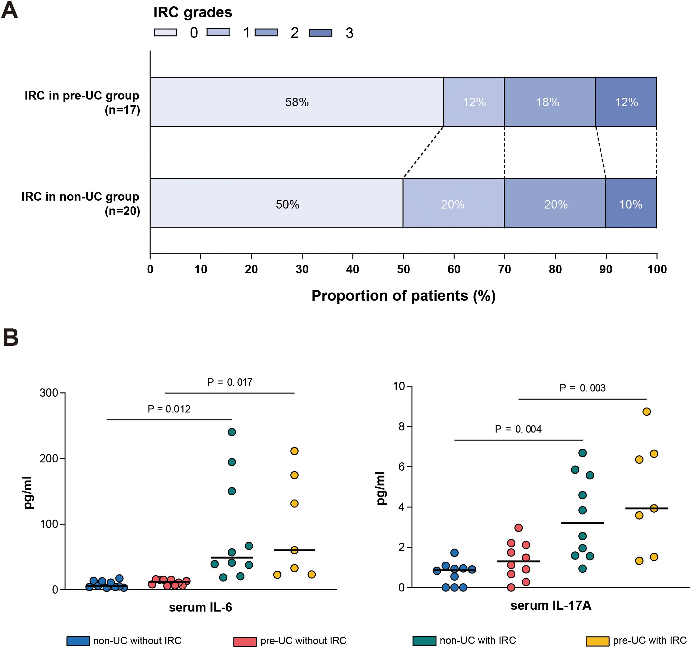 Panel A displays a stacked bar chart showing IRC grades among pre-UC and non-UC patient groups. Pre-UC group has 58% at grade 0, 12% at grade 1, 18% at grade 2, and 12% at grade 3. Non-UC group shows 50% at grade 0, 20% at grade 1, 20% at grade 2, and 10% at grade 3. Panel B features two scatter plots of serum levels: IL-6 and IL-17A. IL-6 plot shows higher levels in pre-UC with IRC, with significant differences noted (p-values: 0.012, 0.017). IL-17A plot also shows higher levels in pre-UC with IRC, with significant differences (p-values: 0.004, 0.003). Different colors indicate sample groups.