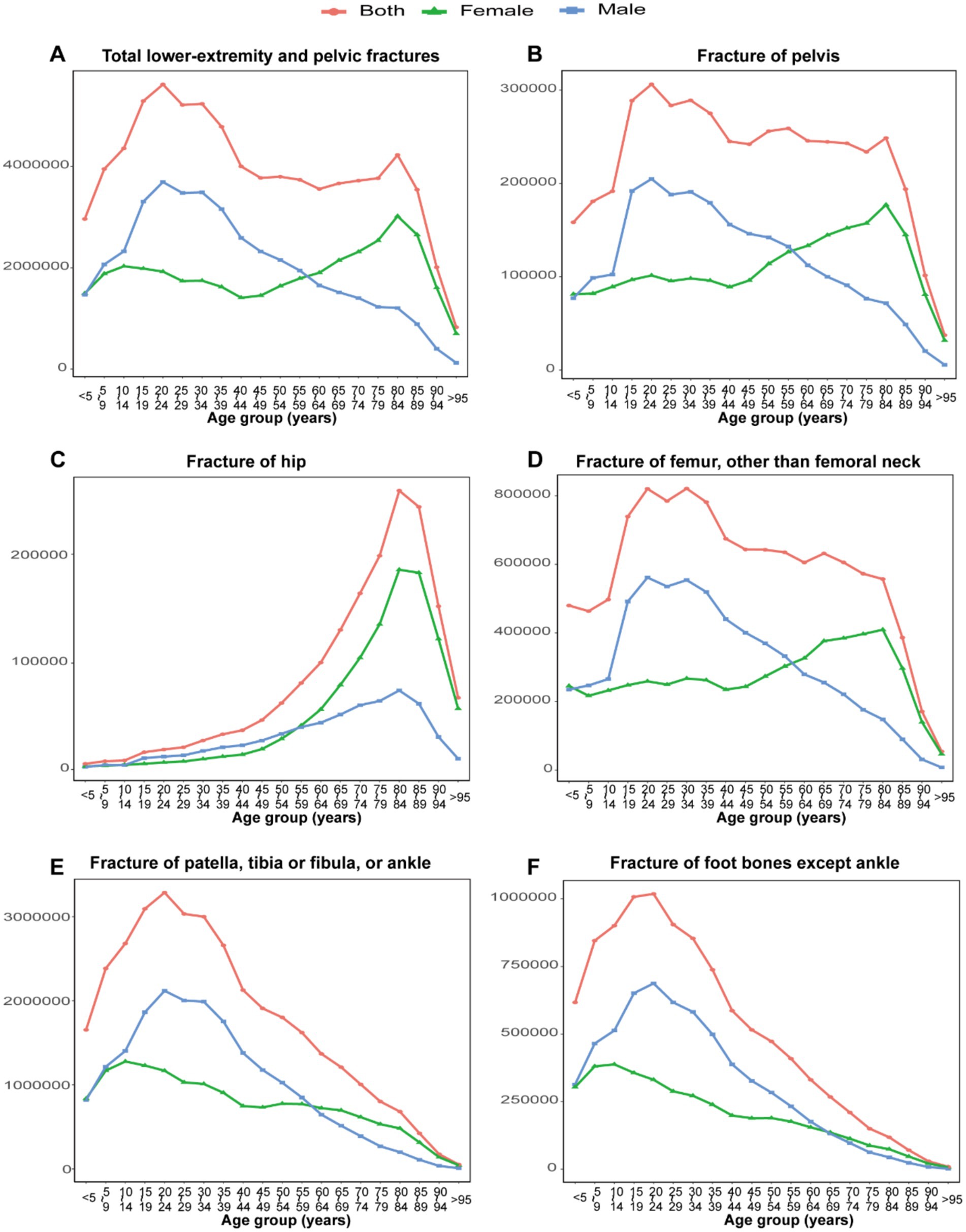 Six line graphs depict fracture rates by age group for both genders. Graph A shows total lower-extremity and pelvic fractures, with rates peaking between ages 75-89. Graph B shows pelvis fractures, highest in those over 70. Graph C displays a sharp increase in hip fractures for ages 75-89. Graph D covers femur fractures, peaking in the same age group. Graph E shows patella, tibia, or fibula fractures, higher in younger age groups. Graph F illustrates foot bone fractures, except ankle, with rates peaking before declining in older age groups. Red represents both genders, green females, blue males.