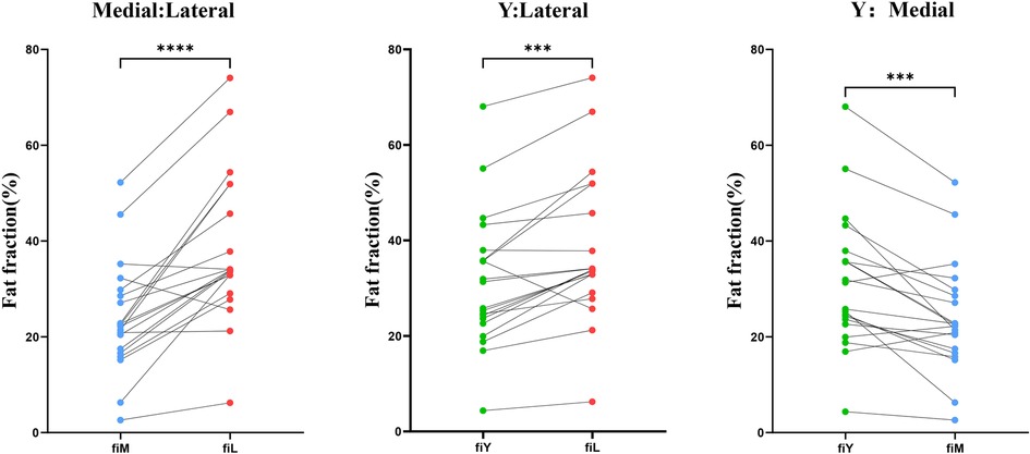 The paired t-tests conducted on the PACS measurement data from the Y-plane, the lateral side, and the medial side. The results show that the degree of fatty infiltration is greatest on the lateral side, followed by the Y-plane, and then the medial side.