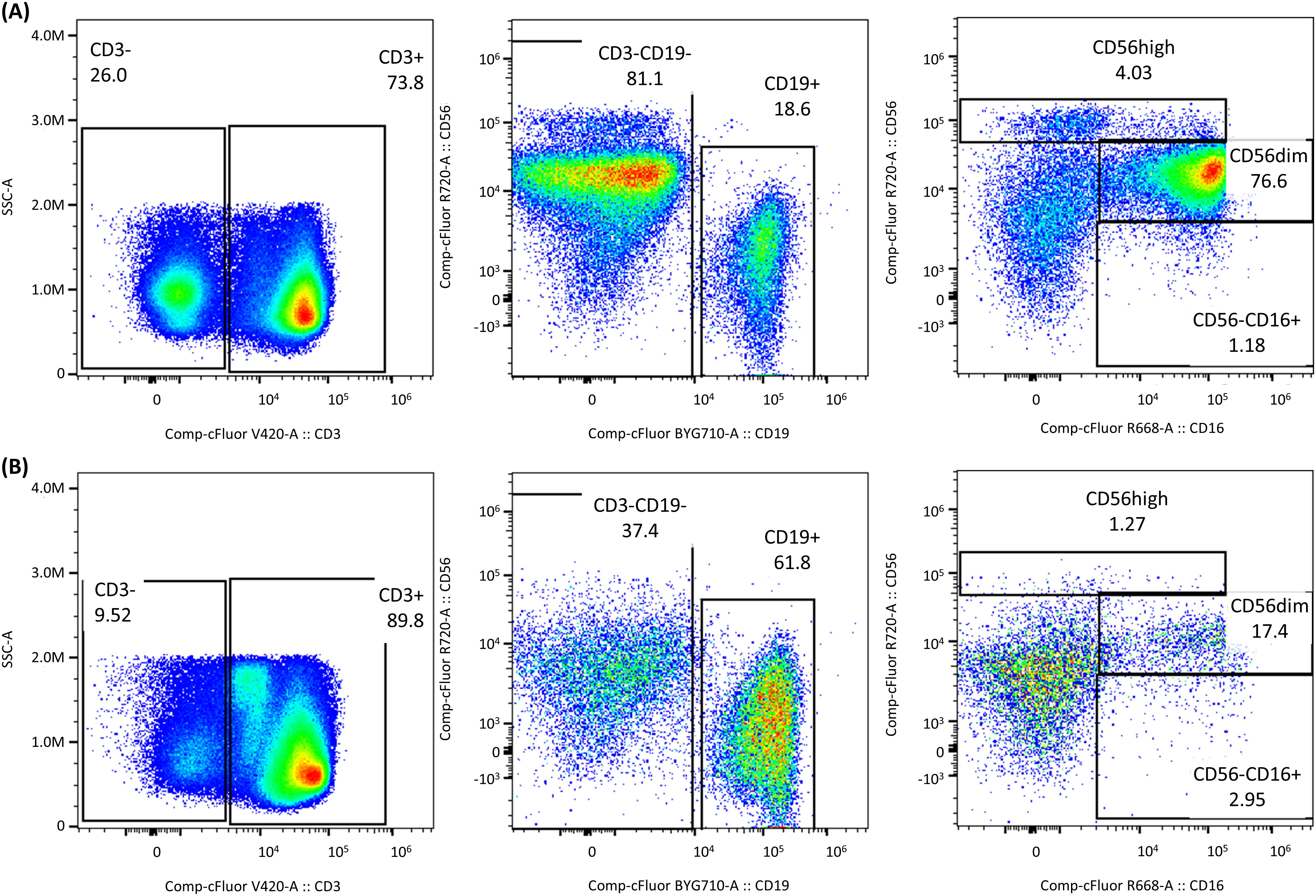 Flow cytometry plots show cell populations in two panels labeled A and B. Panel A has three plots: CD3 versus SSC-A, CD3-CD19 versus CD19, and CD56 versus CD16, indicating cell distribution percentages. Panel B has similar plots with different percentages, highlighting subpopulations CD56 high, dim, and CD16 expressions.