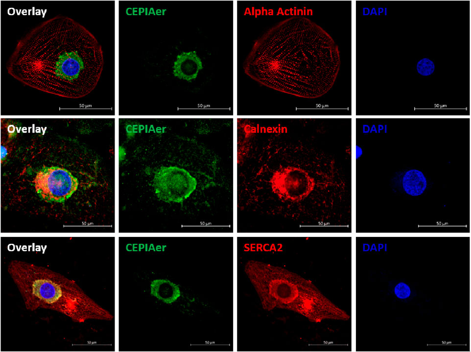 Microscopic images showing cellular markers in cardiomyocytes. First row: Overlay combining CEPIAer (green), Alpha Actinin (red), and DAPI (blue) stains. Second row: Overlay with CEPIAer, Calnexin (red), and DAPI. Third row: Overlay with CEPIAer, SERCA2 (red), and DAPI. Each set illustrates distinct cellular components, highlighting different proteins and structures in muscle cells. Scale bars indicate 50 micrometers.