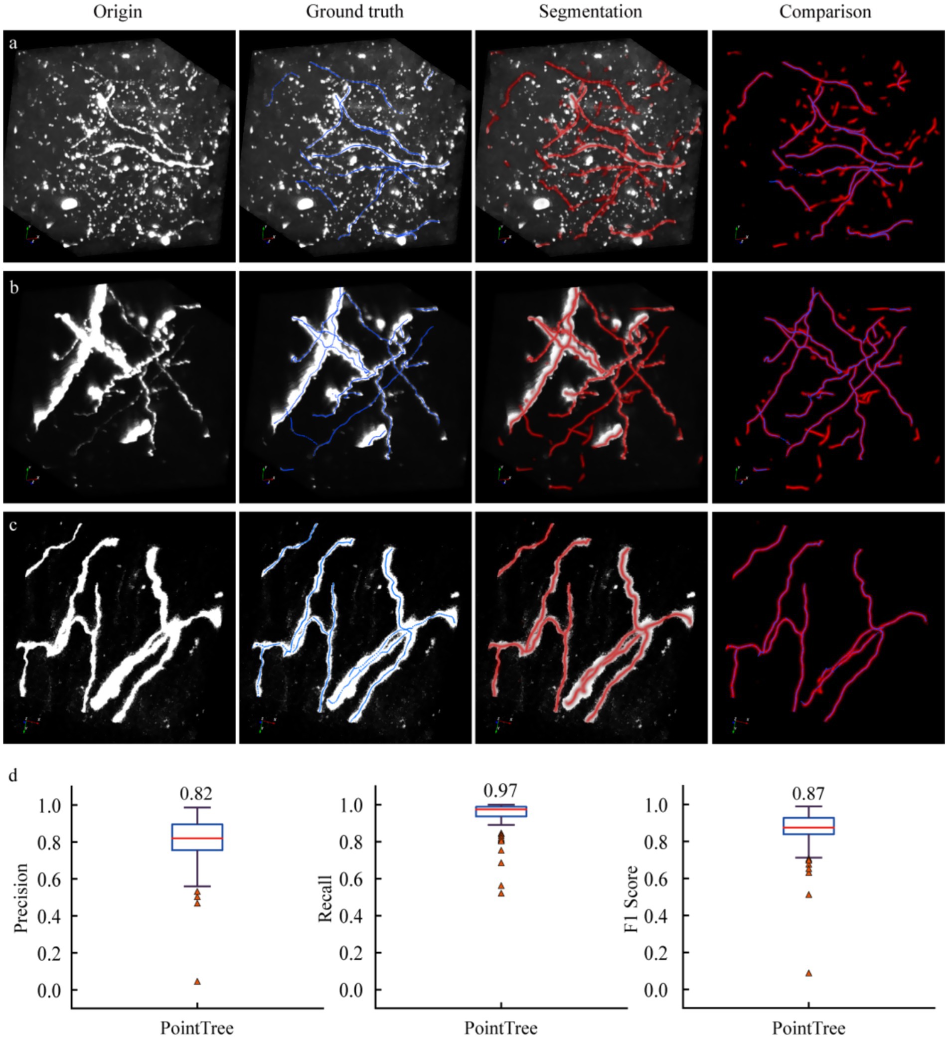 Three rows of images display origin, ground truth, segmentation, and comparison of structures marked in various colors over a dark background. Below, three box plots illustrate precision, recall, and F1 score, each showing the metric's performance for