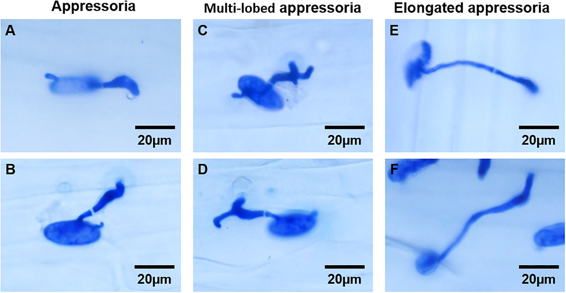 Microscopic images display different types of appressoria in the fungus. Panels A and B show single appressoria, C and D show multi-lobed appressoria, and E and F show elongated appressoria. Each panel includes a scale bar indicating 20 micrometers.