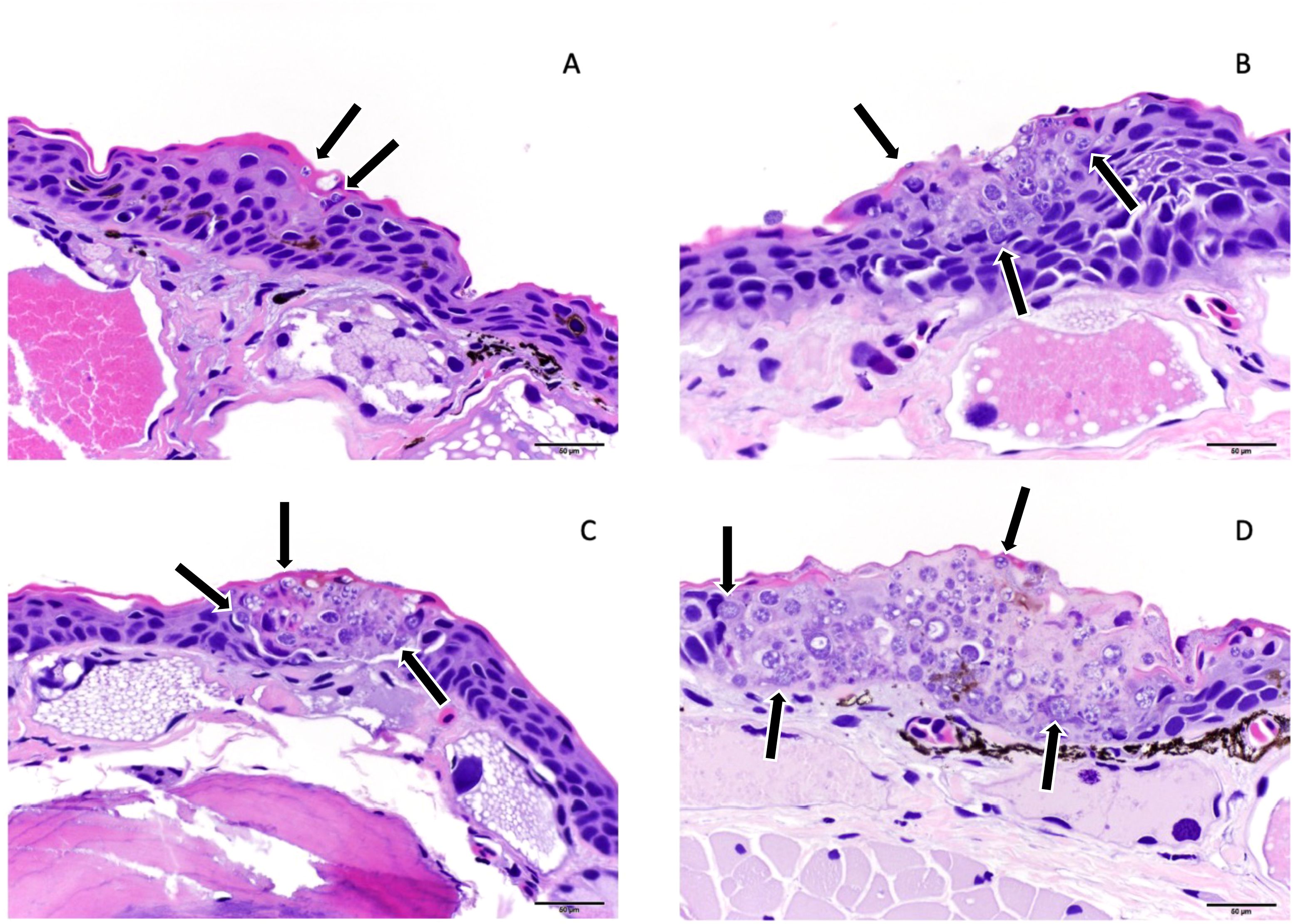 Histological images of skin tissue showing detailed cellular structures in four panels labeled A, B, C, and D. Each panel highlights areas with dark arrows pointing to specific features within the layers of cells, stained in varying shades of purple and pink, with a scale bar indicating dimensions.
