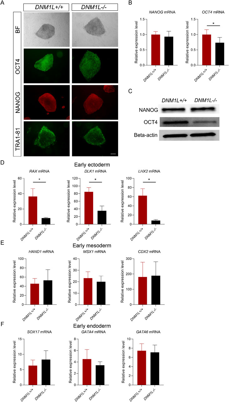 Panel A shows bright-field and immunofluorescence images for OCT4, NANOG, and TRA1-81 in DNM1L+/+ and DNM1L-/- cells. Panel B presents bar graphs comparing NANOG and OCT4 mRNA levels with significantly reduced OCT4 in DNM1L-/- cells. Panel C displays Western blots for NANOG, OCT4, and beta-actin. Panels D, E, and F present bar graphs for mRNA expression of early ectoderm (RAX, DLK1, LHX2), early mesoderm (HAND1, MSX1, CDX2), and early endoderm (SOX17, GATA4, GATA6), showing differences between DNM1L+/+ and DNM1L-/- cells.
