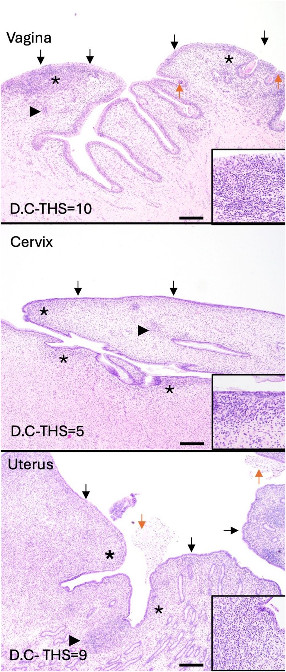 Microscopic images show sections of the vagina, cervix, and uterus. Each section is labeled with arrows and asterisks highlighting specific areas of interest. Insets provide detailed views of tissue structure. D.C-THS values indicate density contrast for each section, with scores of ten for the vagina, five for the cervix, and nine for the uterus. Scale bars are present for size reference.
