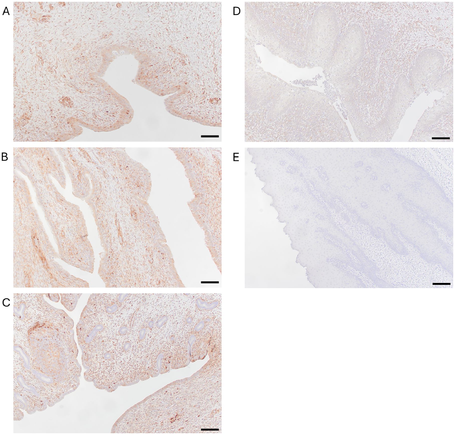 Histological images labeled A to E showing varying structures and staining patterns of tissue sections. Panels A, B, and C display more distinct staining, indicating positive expression, with cellular and structural variations. Panels D and E show lighter staining, suggesting lesser or negative expression. Each image includes a scale bar for reference.