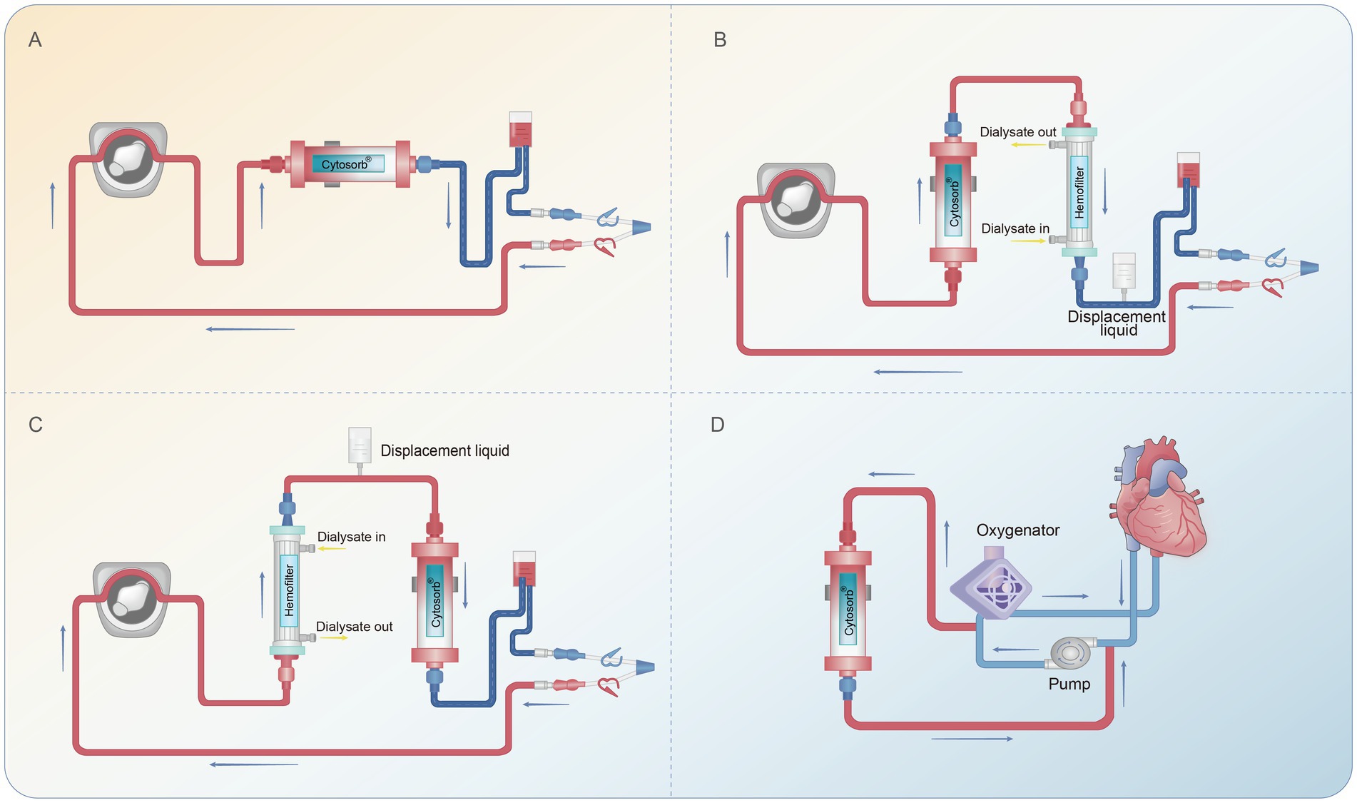 Diagram illustrating four CytoSorb blood purification setups: A) basic flow through CytoSorb. B) integration with a hemofilter and dialysate. C) another hemofilter configuration with dialysate. D) connection with an oxygenator and pump, showing heart-lung bypass circuit. Arrows indicate flow direction.