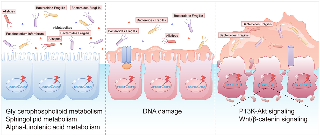 Diagram illustrating the effects of different bacteria on cellular processes across three panels. The left panel shows bacteria like Alistipes affecting lipid metabolism. The middle panel depicts DNA damage with Bacteroides Fragilis. The right panel shows P13K-Akt and Wnt/β-catenin signaling involved with these bacteria, leading to changes in cell appearance. Cells appear more damaged and inflamed as panels progress from left to right.