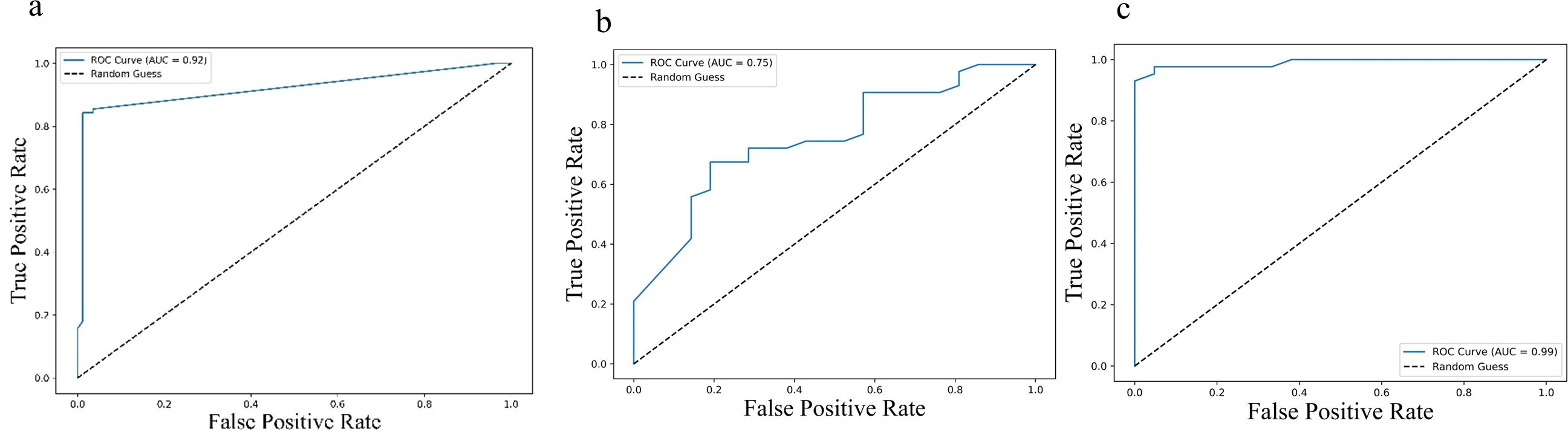 Three ROC curve graphs show the relationship between the true positive rate and false positive rate. The first graph has an AUC of 0.92, the second has an AUC of 0.75, and the third has an AUC of 0.99. Each graph includes a diagonal line representing a random guess.